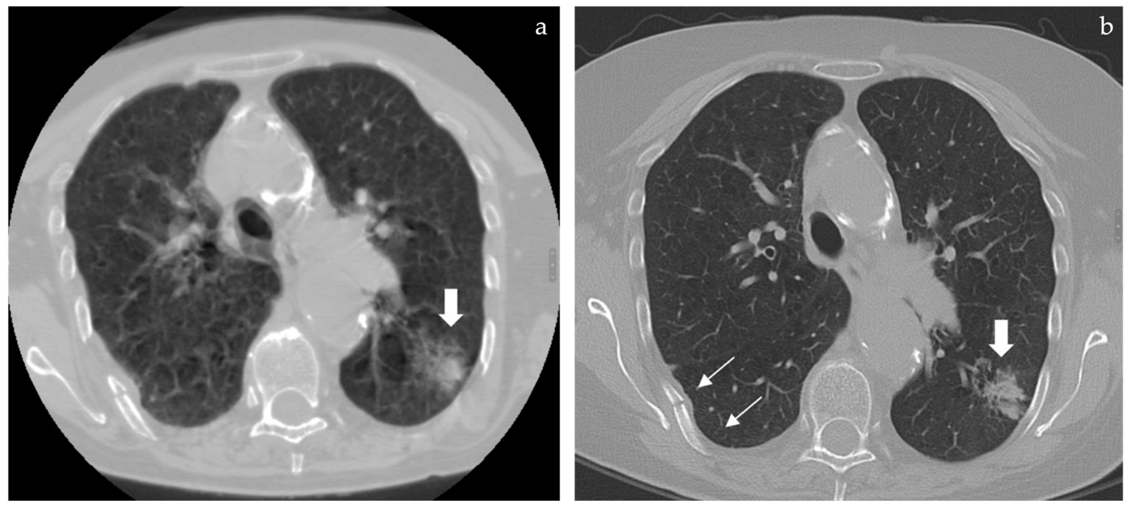 Tomography 08 00080 g002
