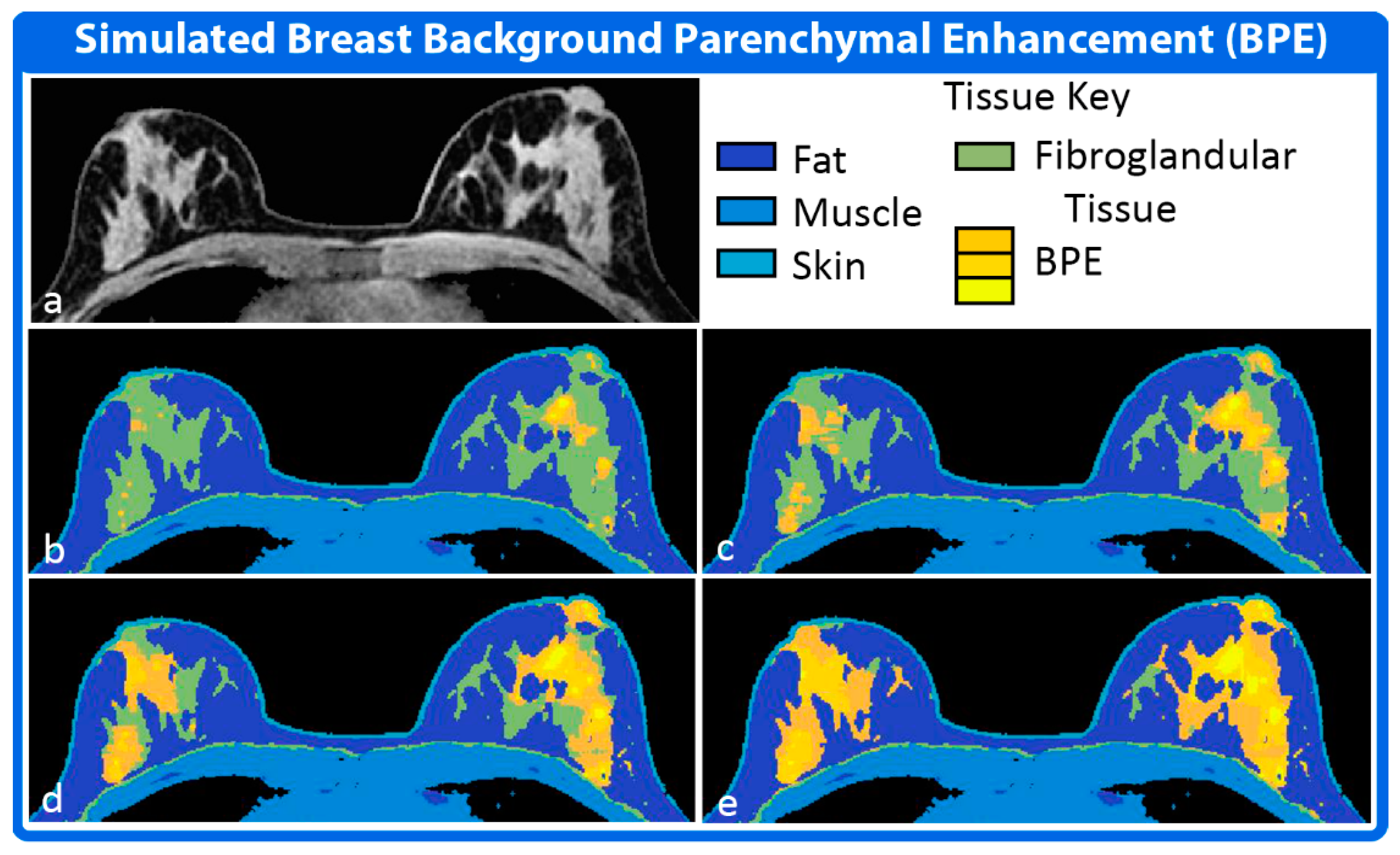 Tomography 08 00081 g004