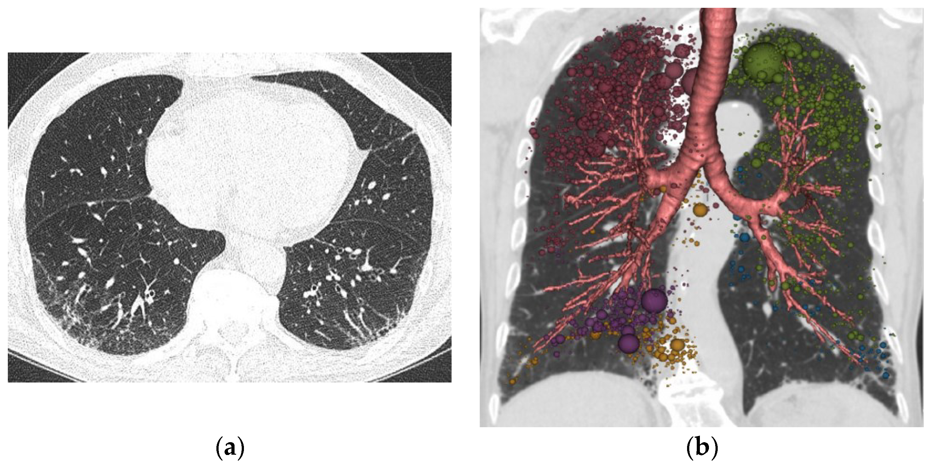 Tomography 08 00082 g003 Tomography 08 00082 g003