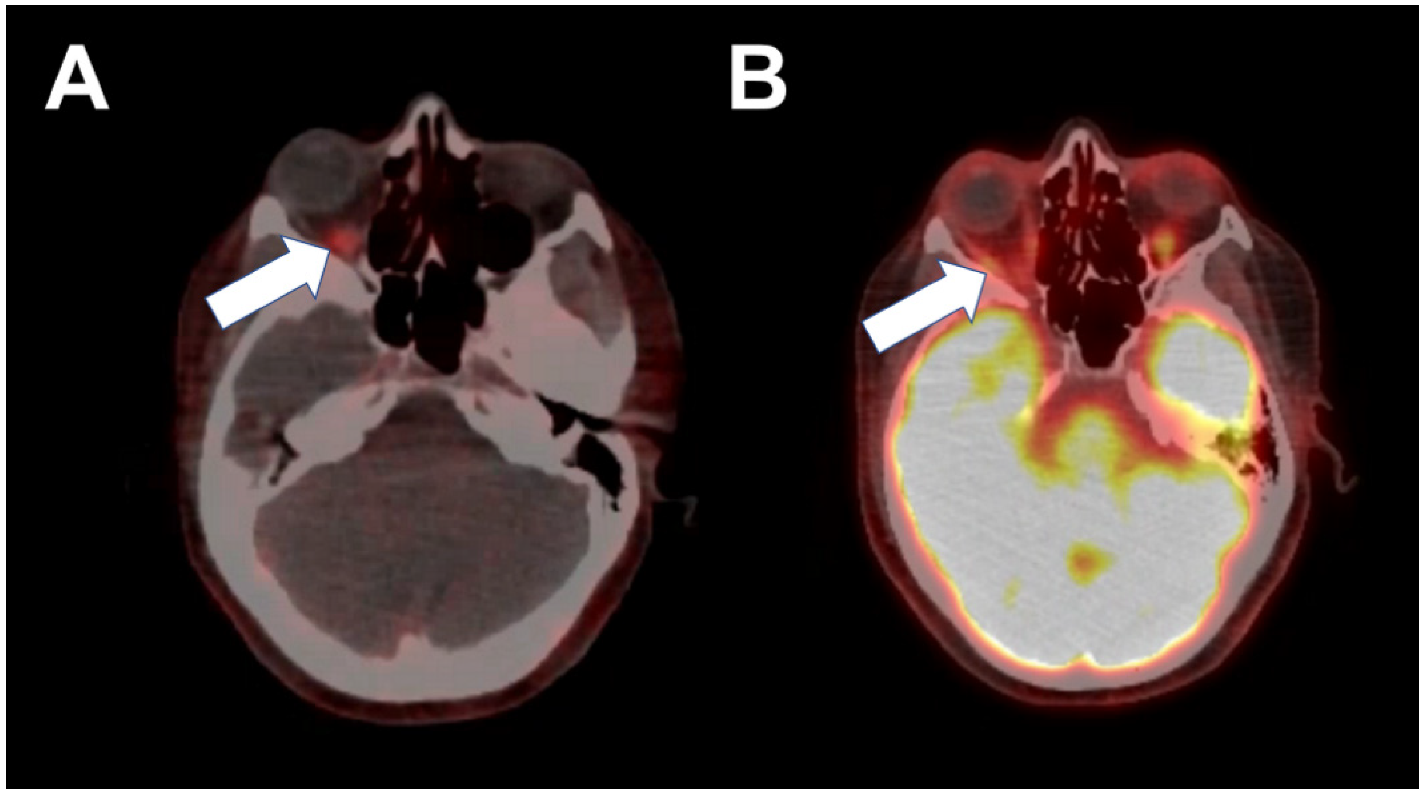 Tomography 08 00086 g001 550