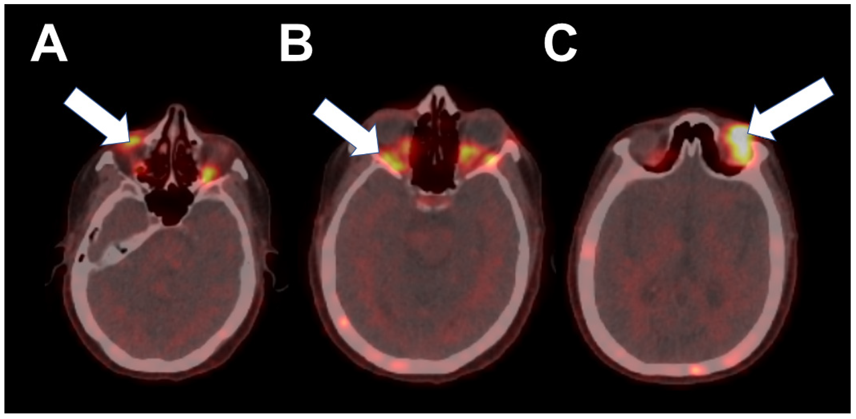 Tomography 08 00086 g003 550