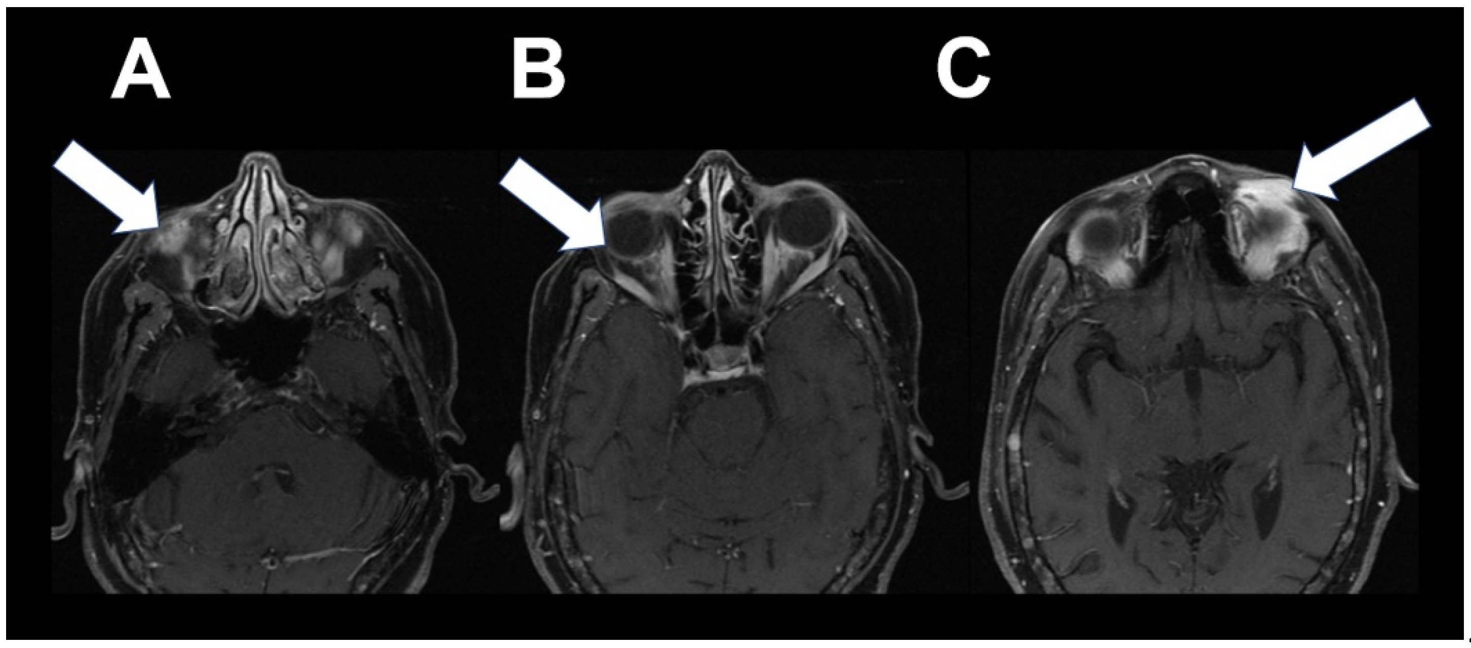 Tomography 08 00086 g004 550