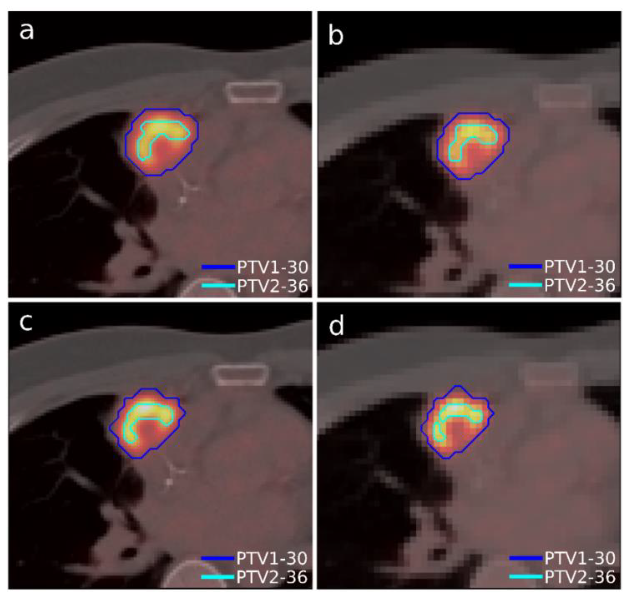Tomography 08 00090 g003