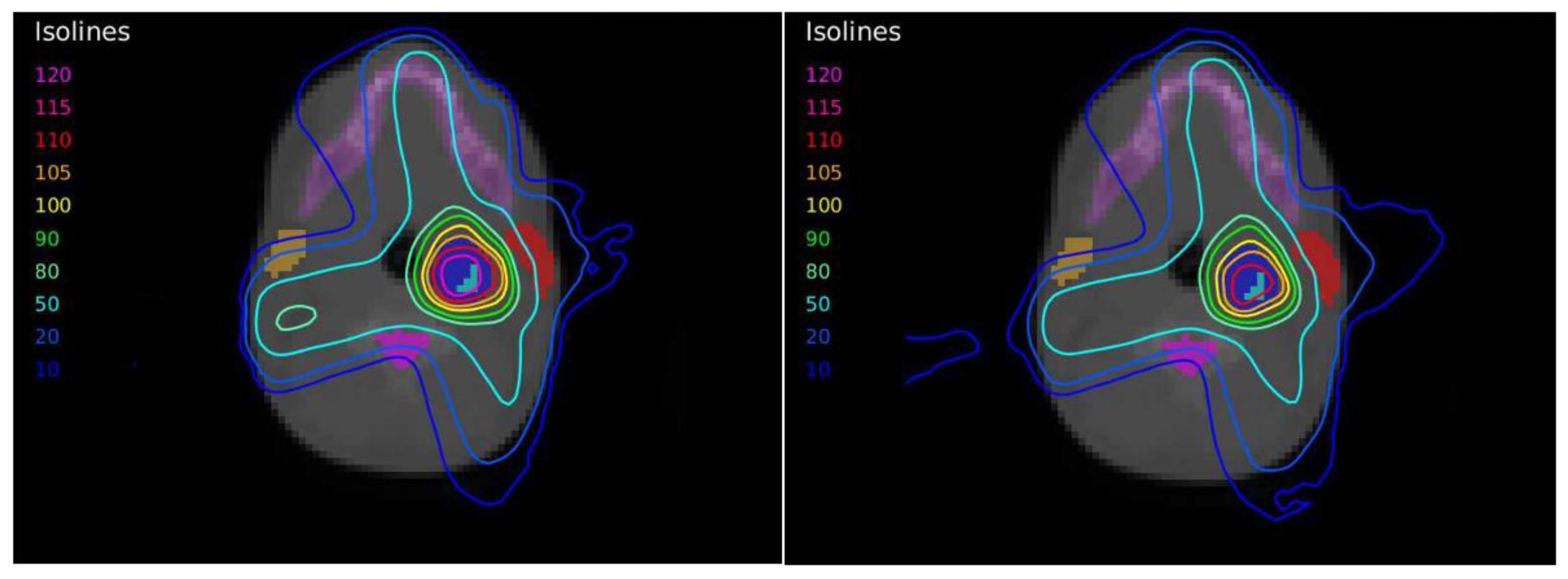 Tomography 08 00090 g005