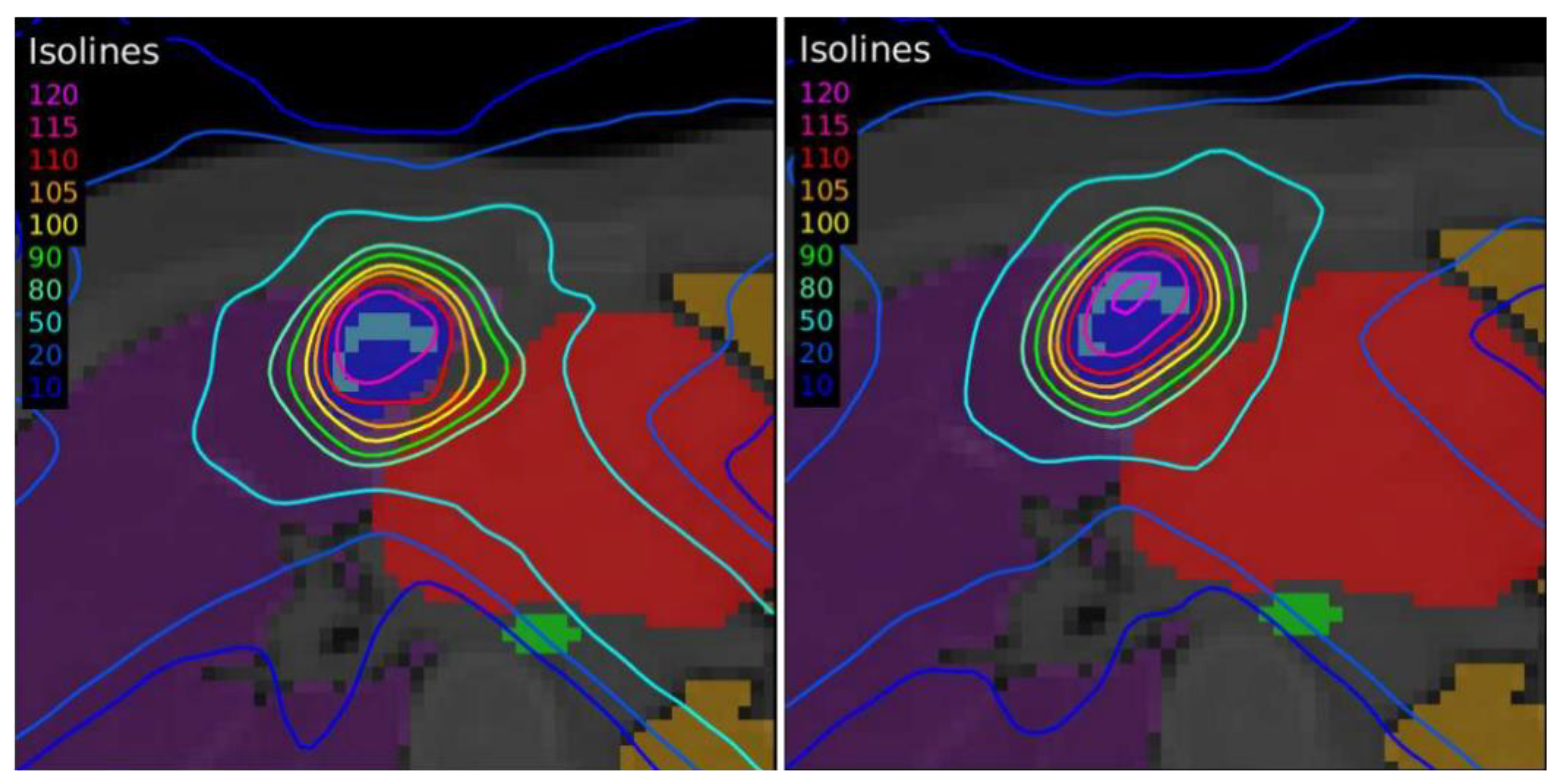Tomography 08 00090 g007
