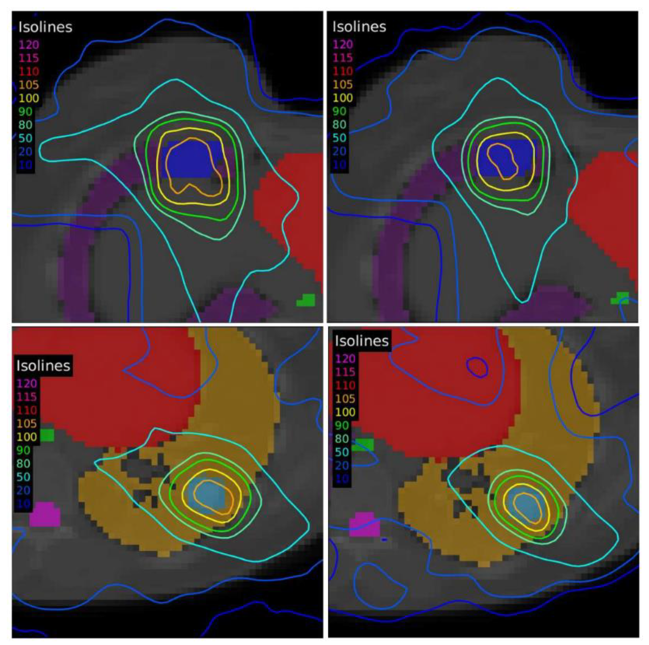 Tomography 08 00090 g009