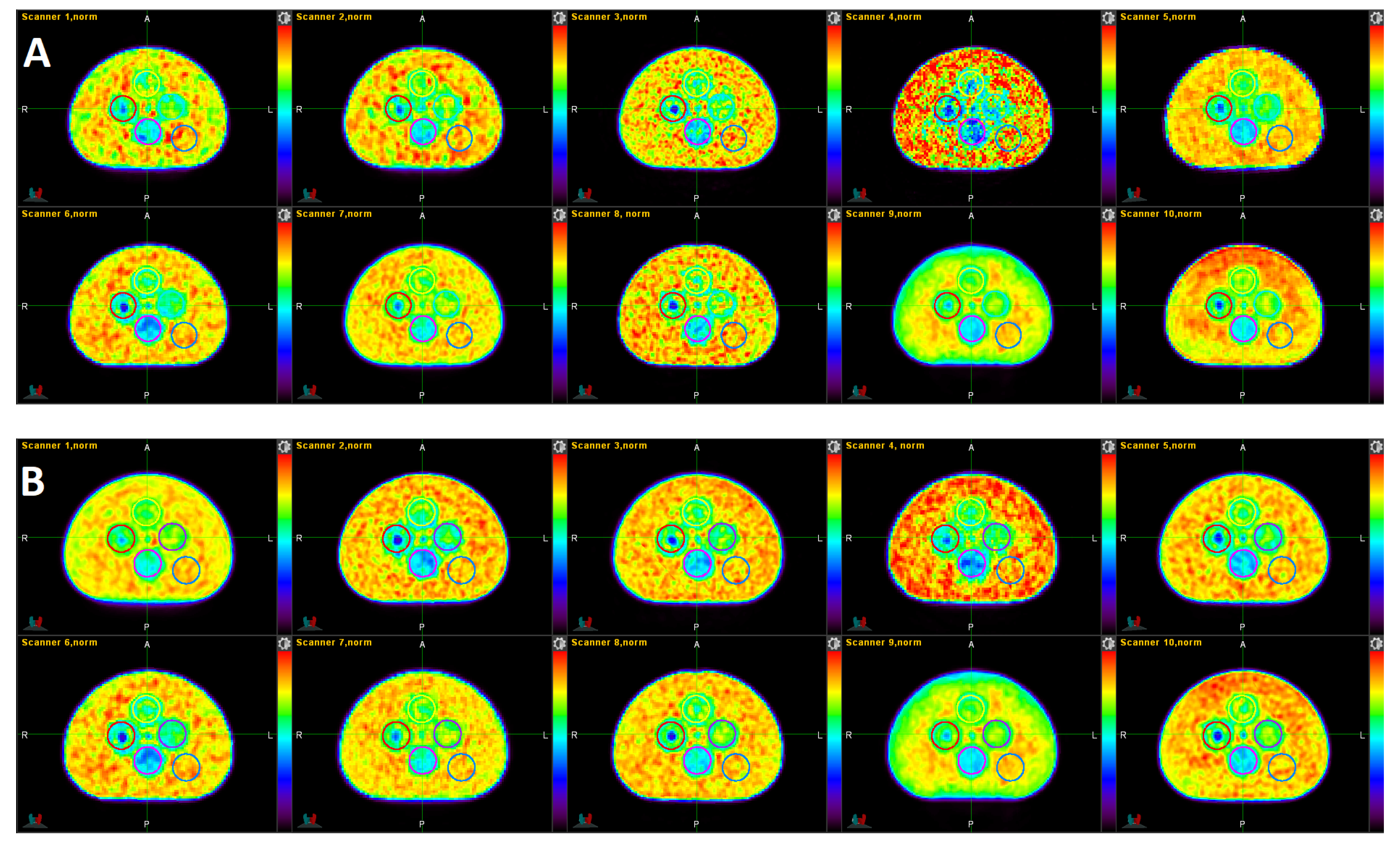 Tomography 08 00091 g002
