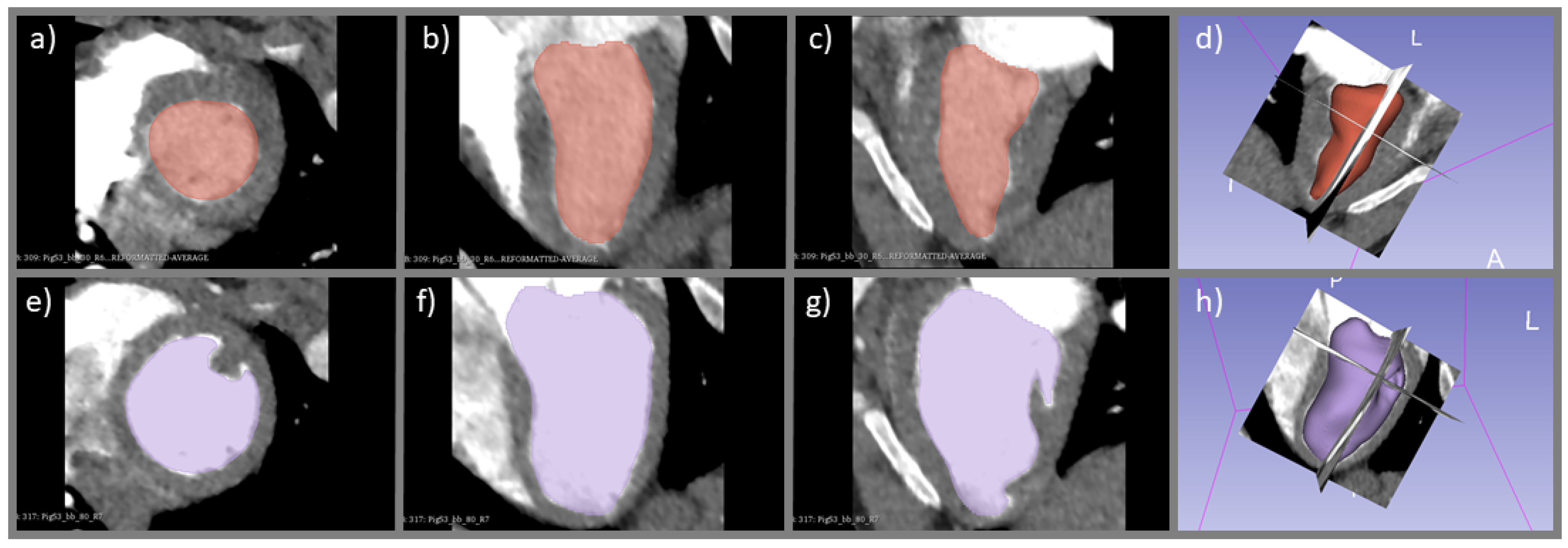 Tomography 08 00092 g003