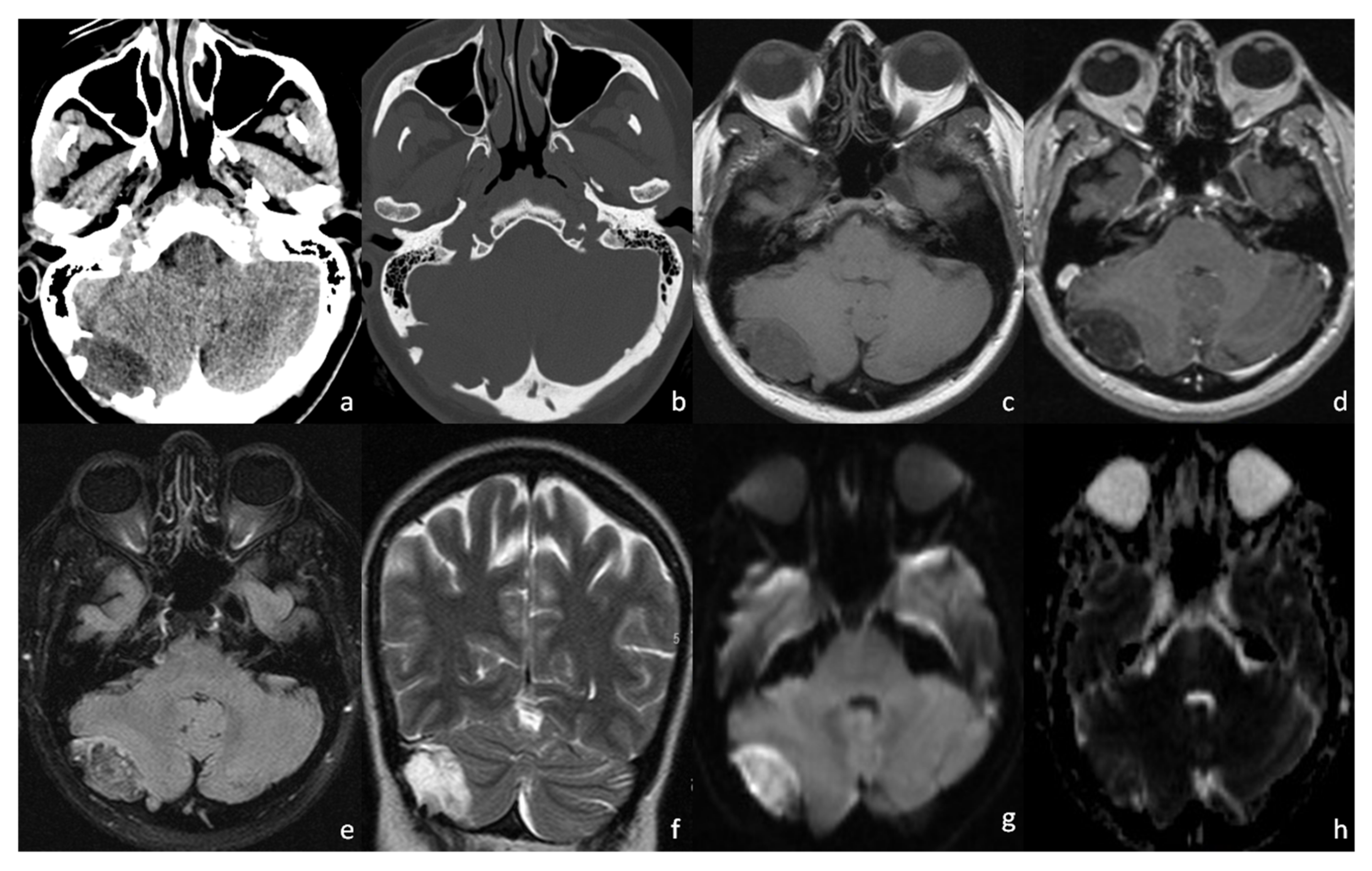 Tomography 08 00093 g003 Tomography 08 00093 g003