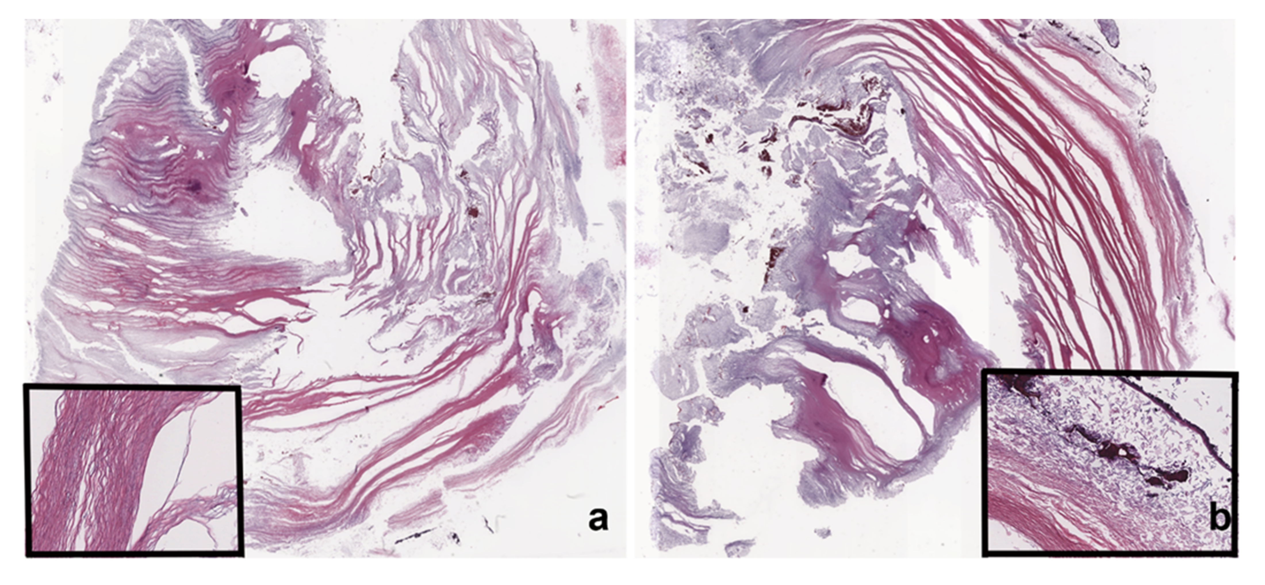 Tomography 08 00093 g004 Tomography 08 00093 g004