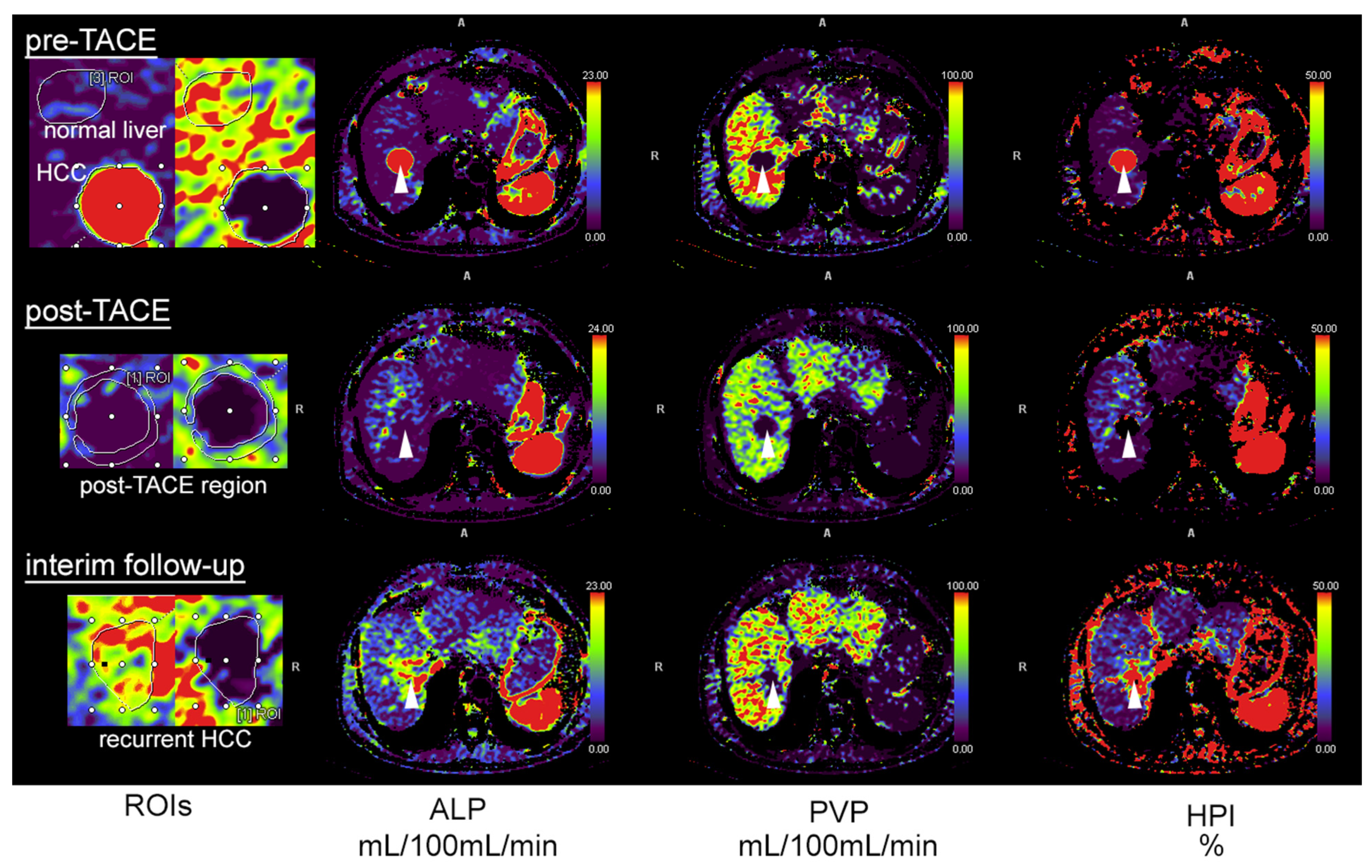 Tomography 08 00094 g001 550