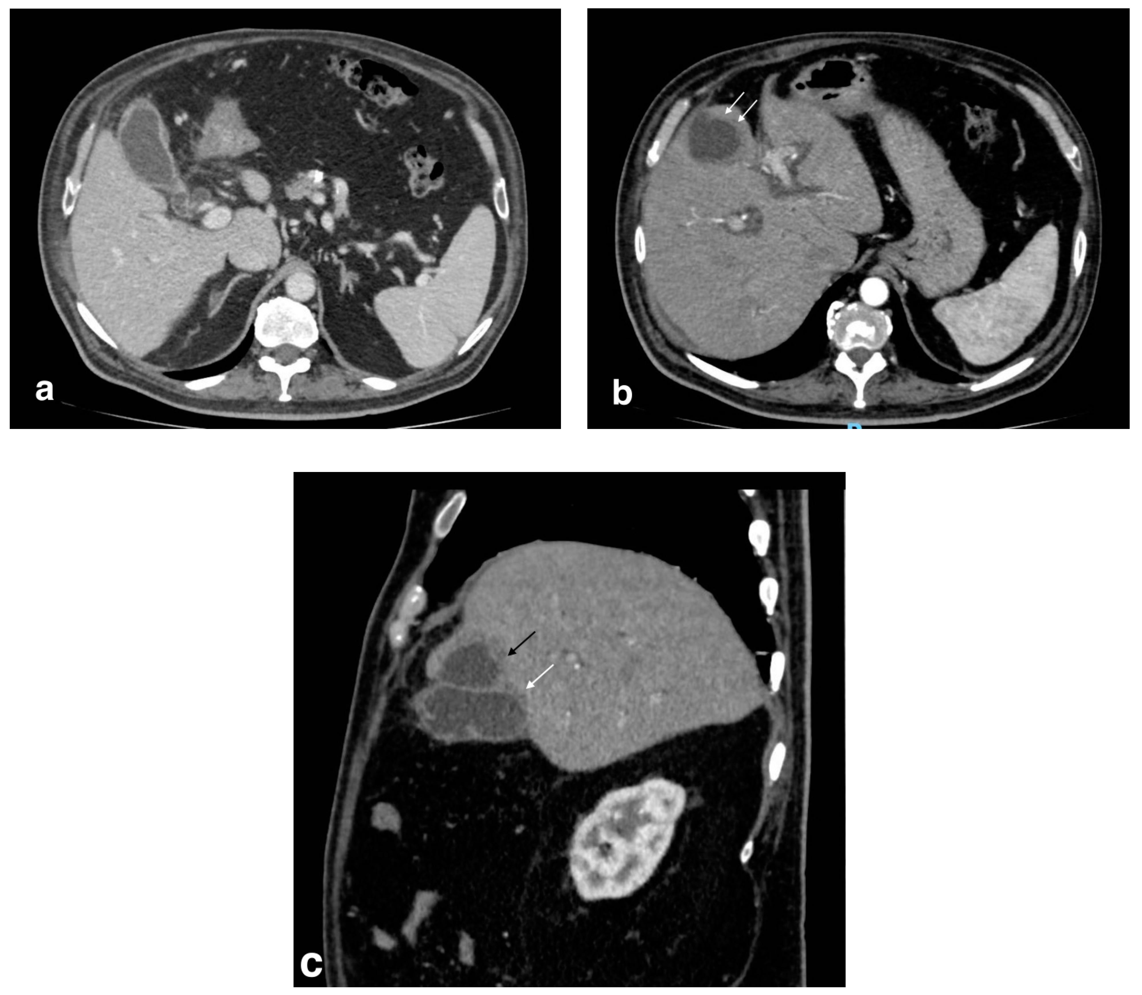 Tomography 08 00095 g008