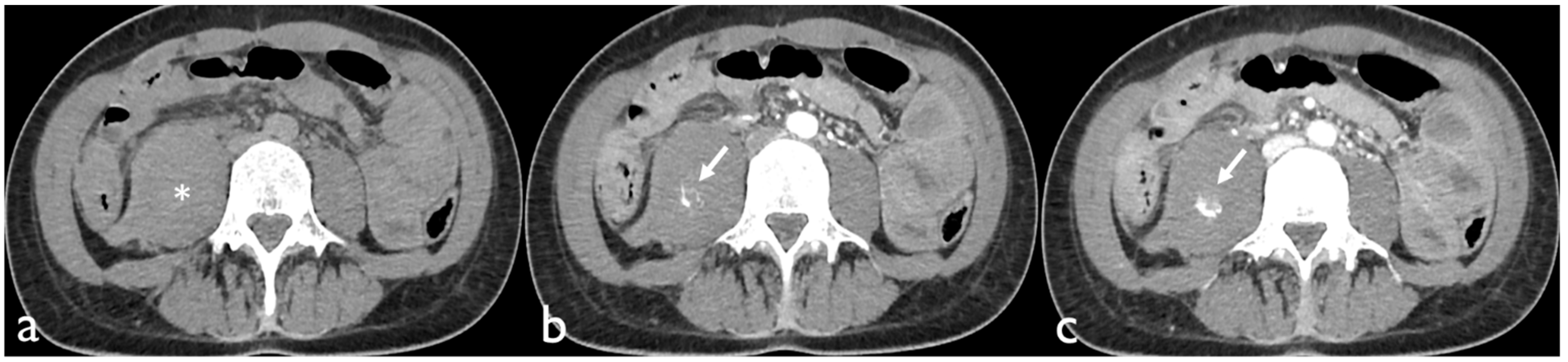 Tomography 08 00101 g001 550