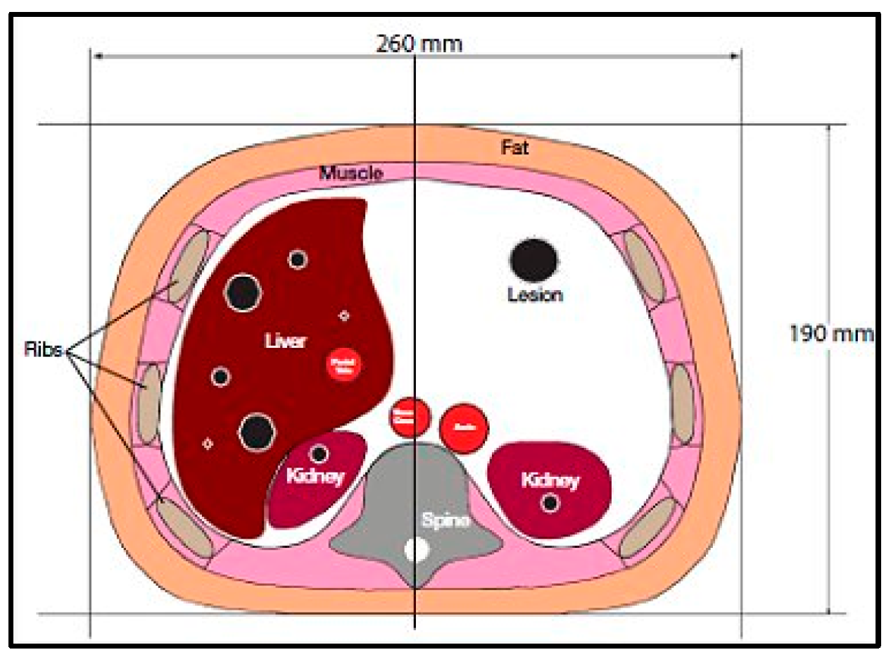 Tomography 08 00103 g001 550