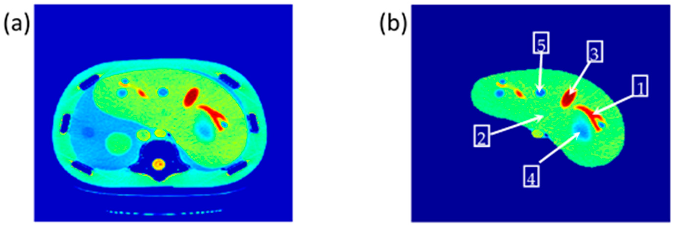 Tomography 08 00103 g002 550