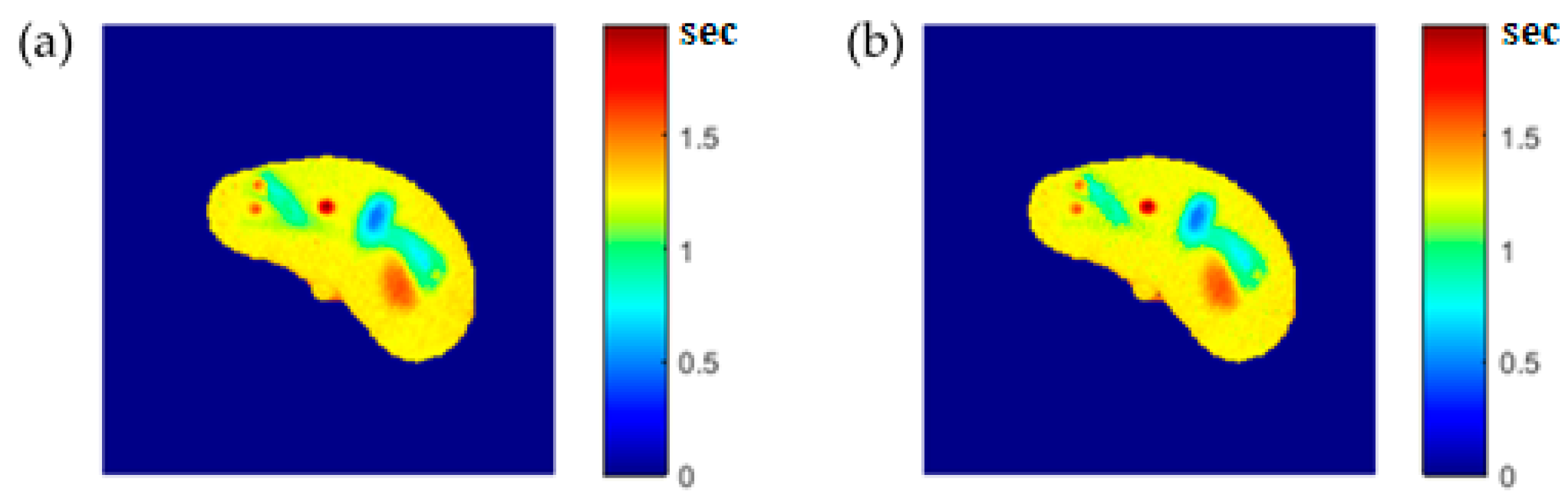 Tomography 08 00103 g006 550
