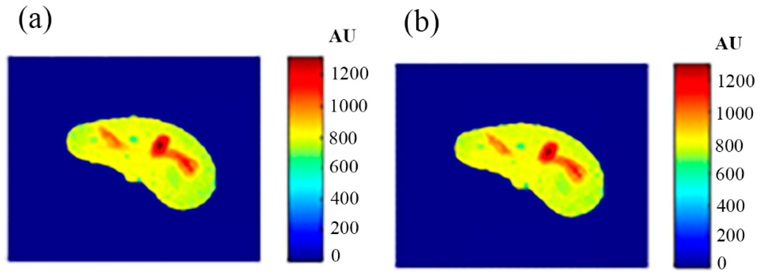 Tomography 08 00103 g010 550