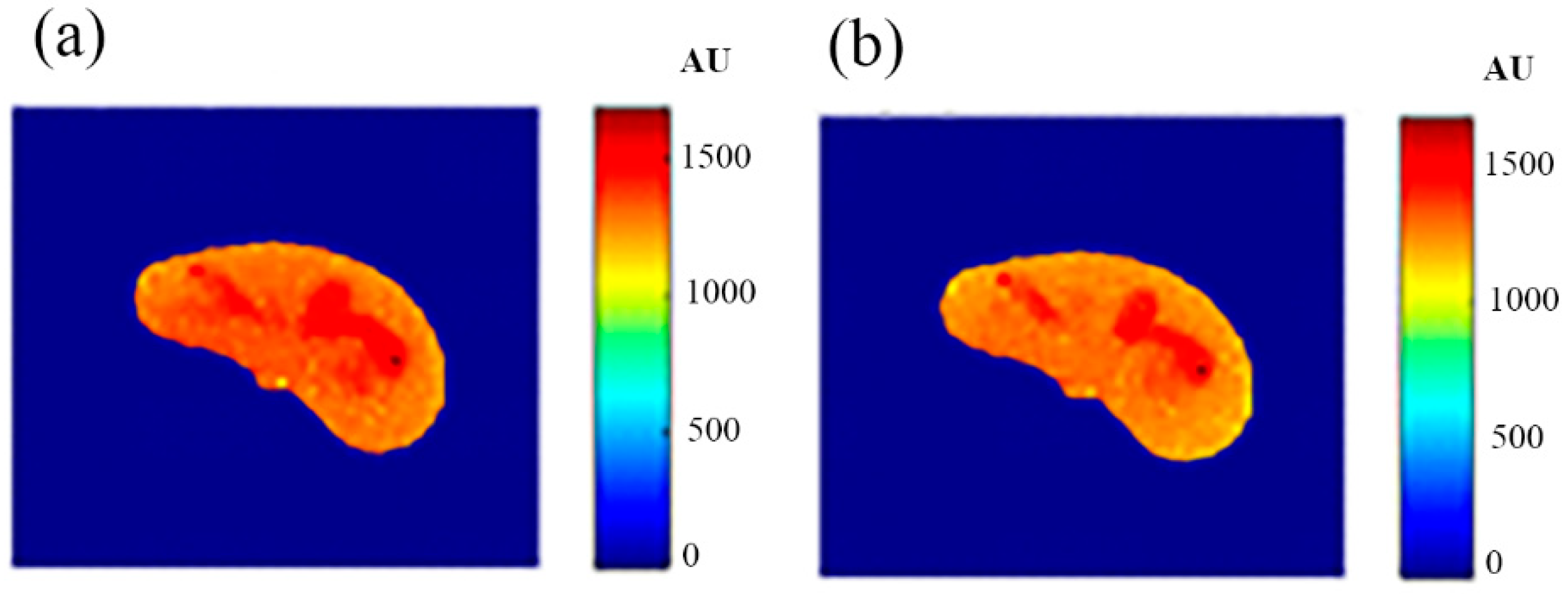 Tomography 08 00103 g011 550