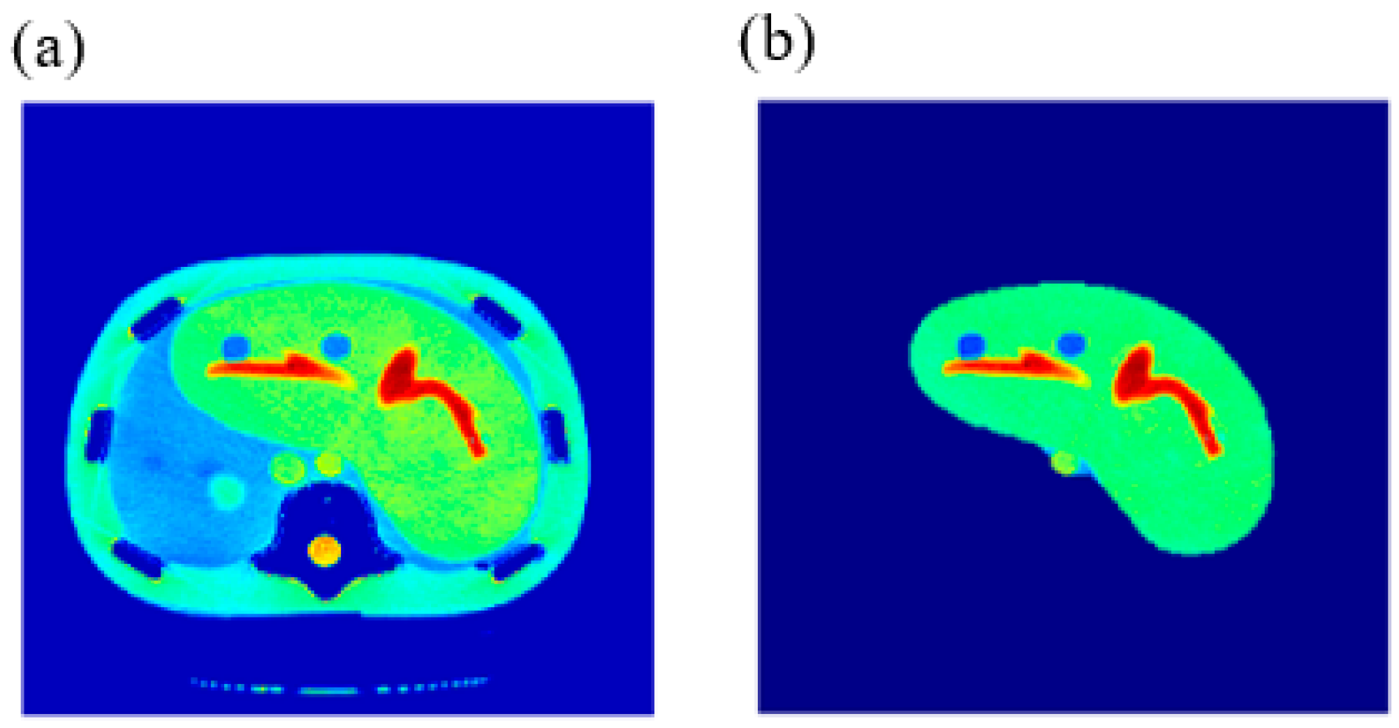 Tomography 08 00103 g013 550