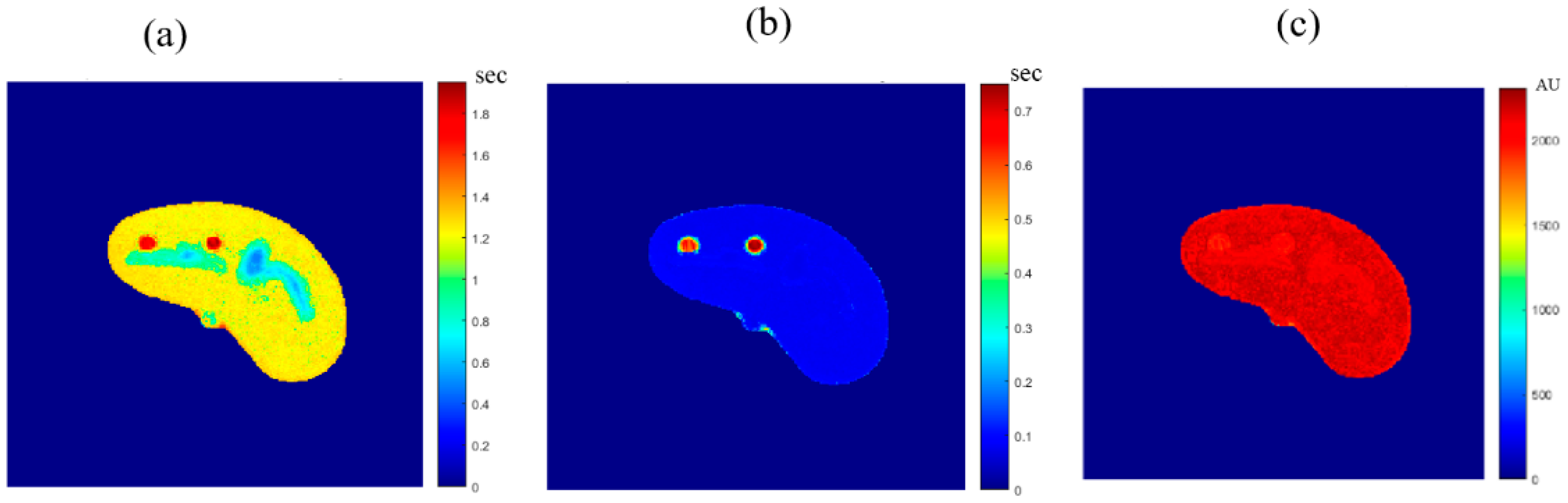 Tomography 08 00103 g014 550
