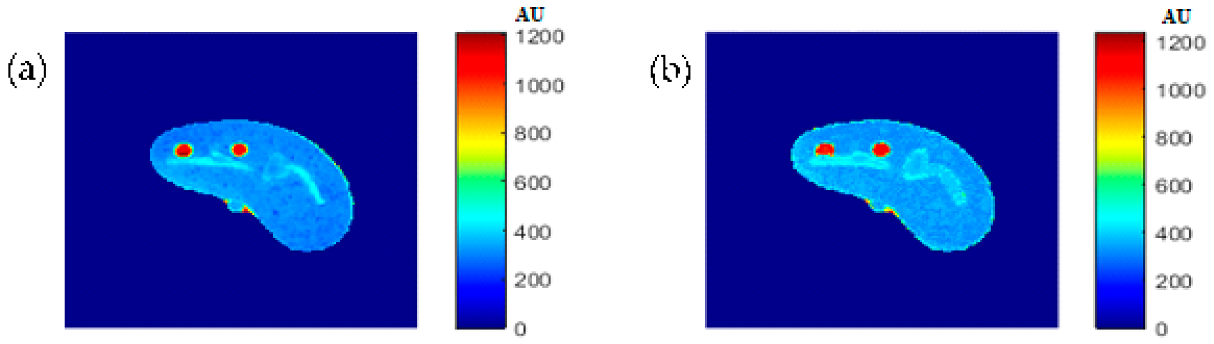 Tomography 08 00103 g016 550