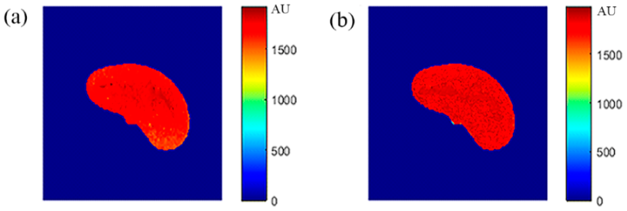 Tomography 08 00103 g017 550