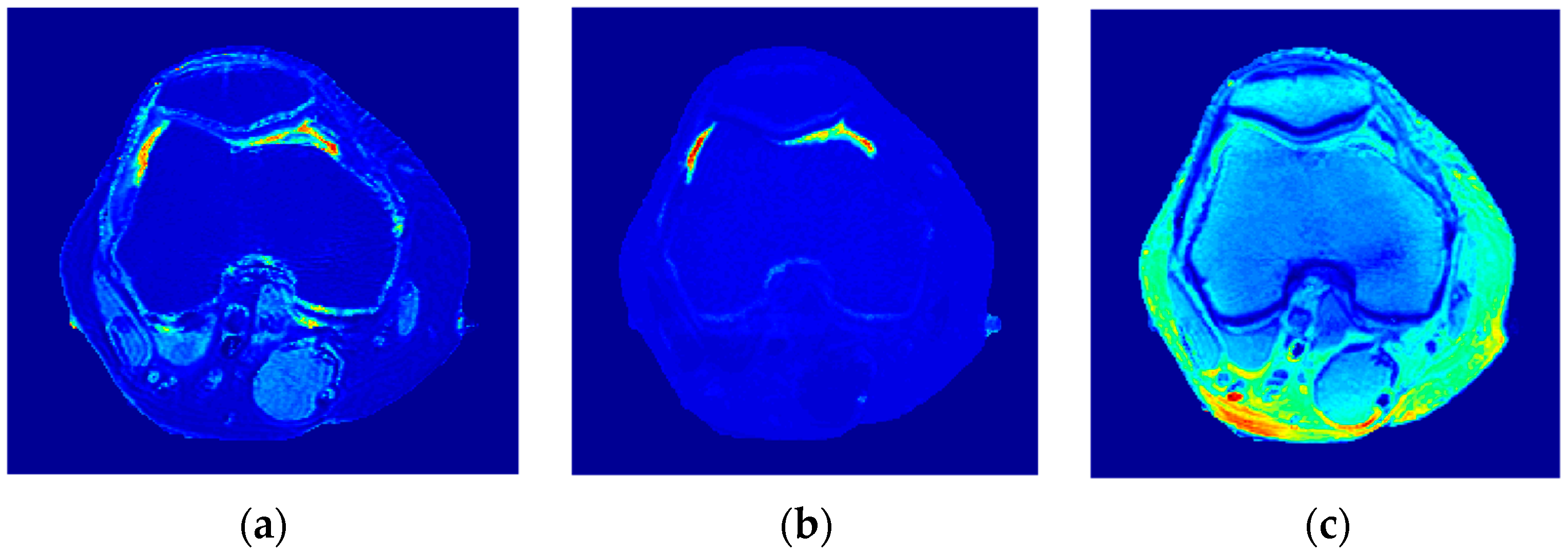 Tomography 08 00103 g018 550