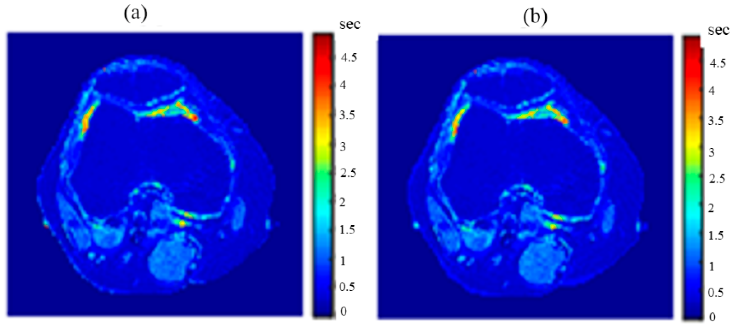 Tomography 08 00103 g020 550