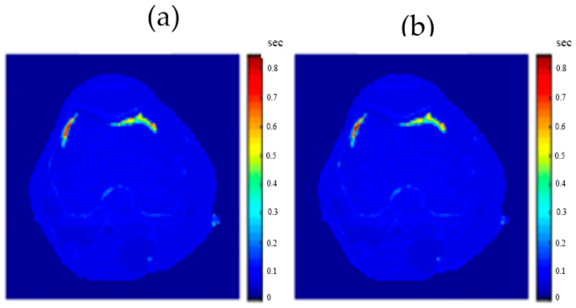 Tomography 08 00103 g021 550