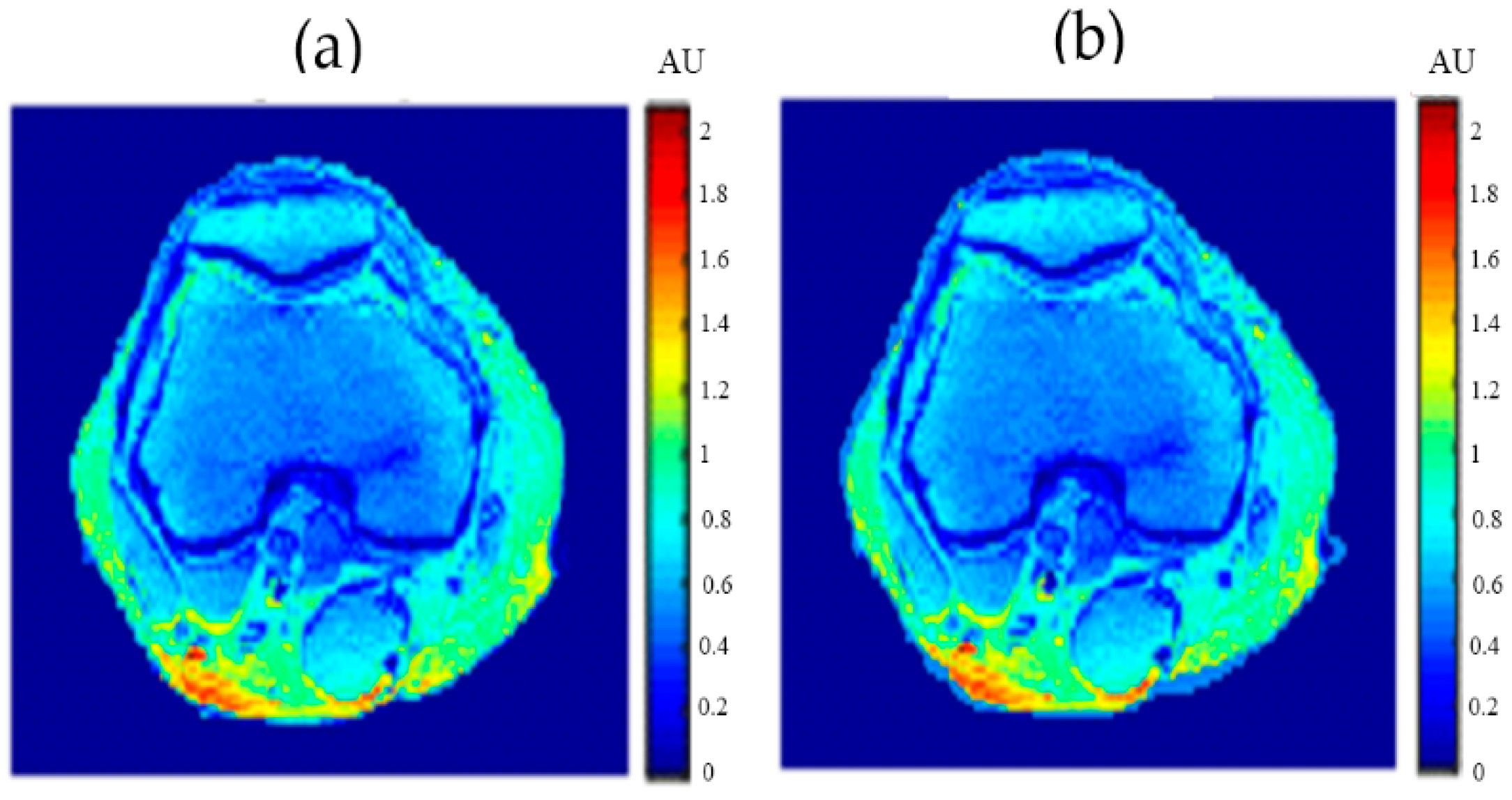 Tomography 08 00103 g022 550