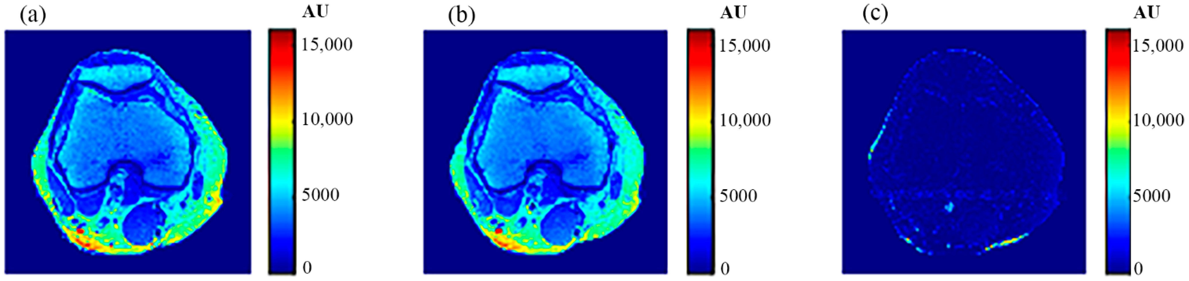Tomography 08 00103 g023 550