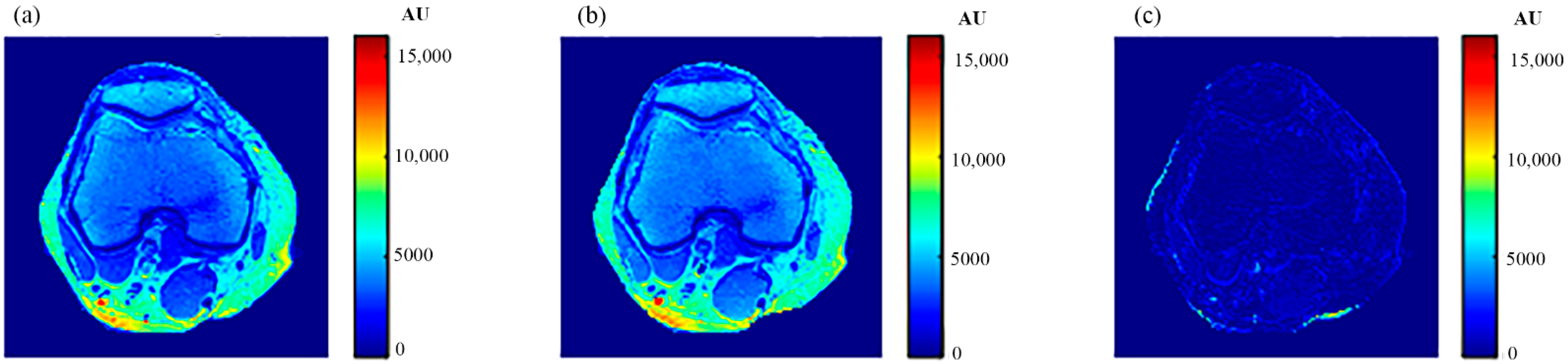 Tomography 08 00103 g024 550