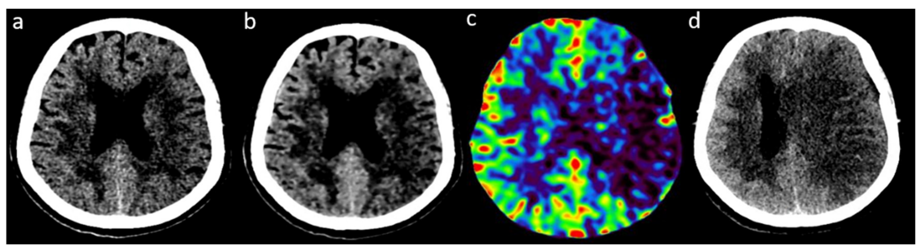 Tomography 08 00104 g004