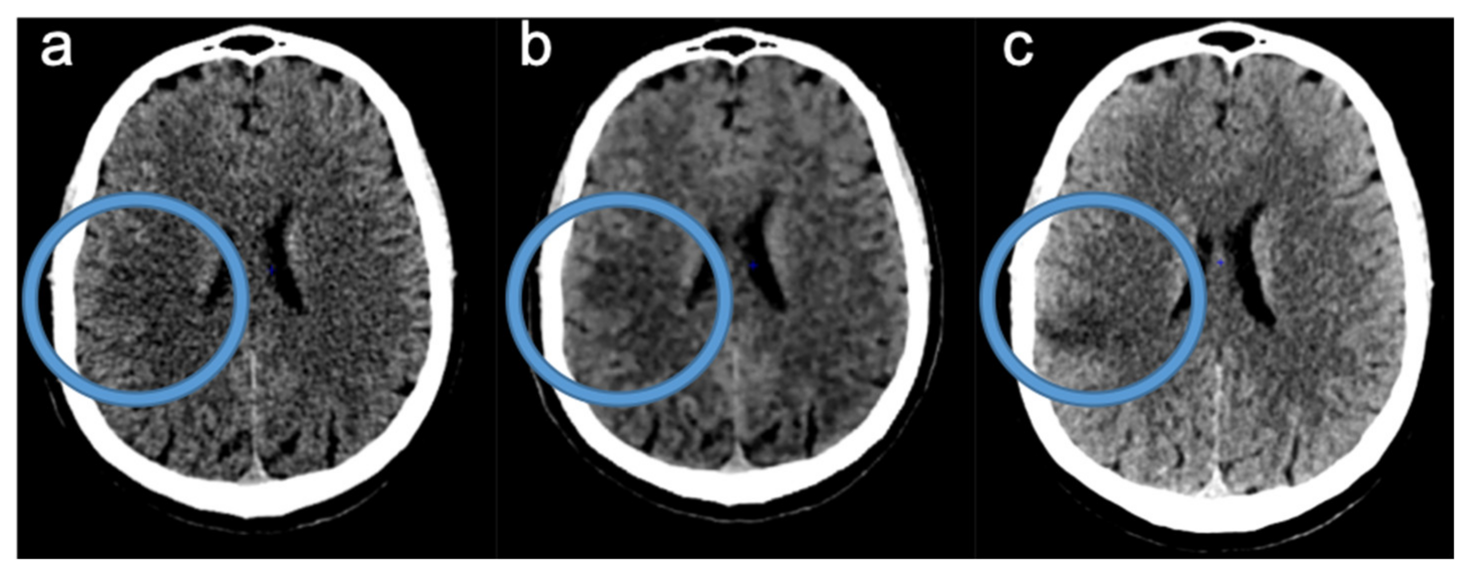 Tomography 08 00104 g005