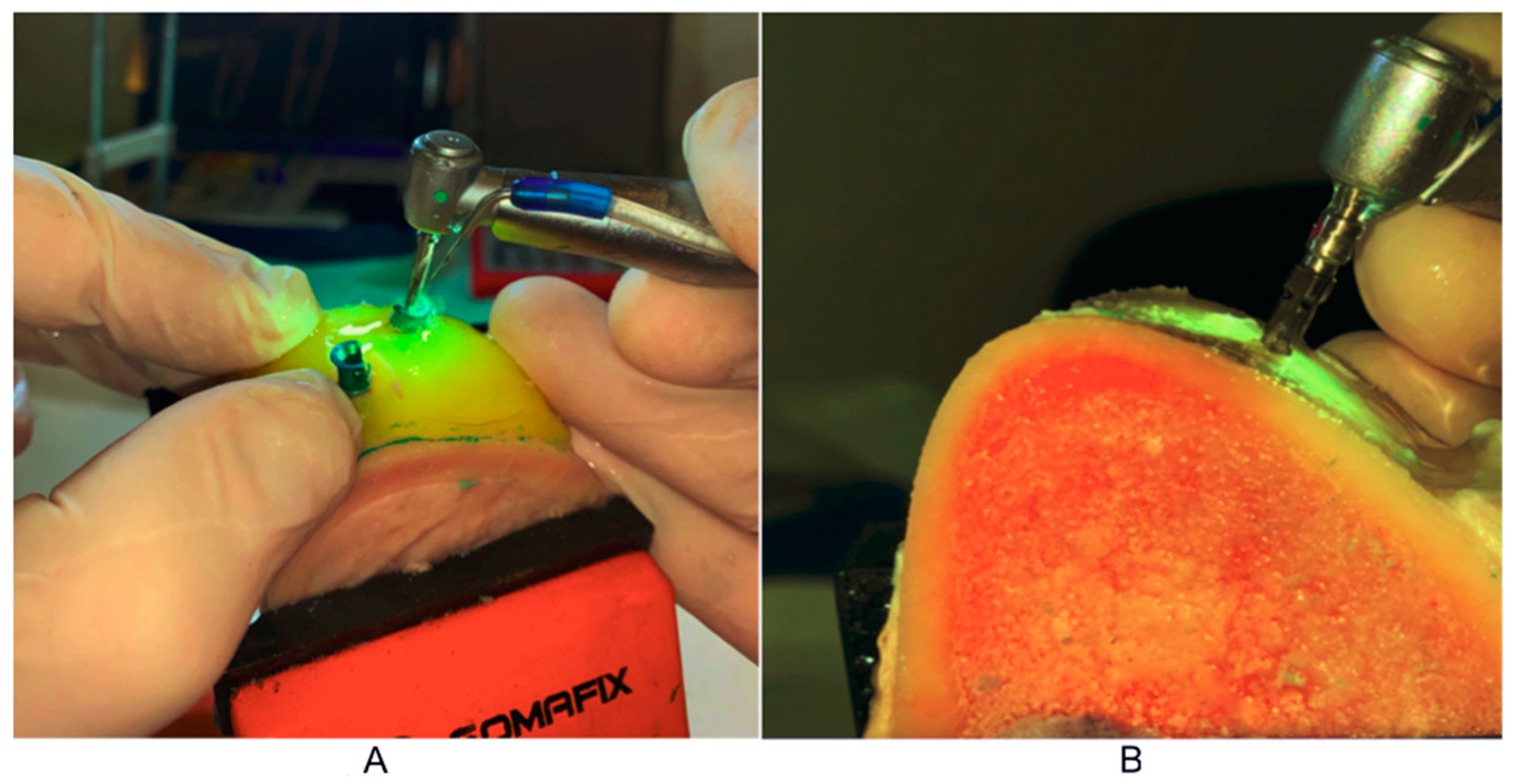 Tomography 08 00107 g003