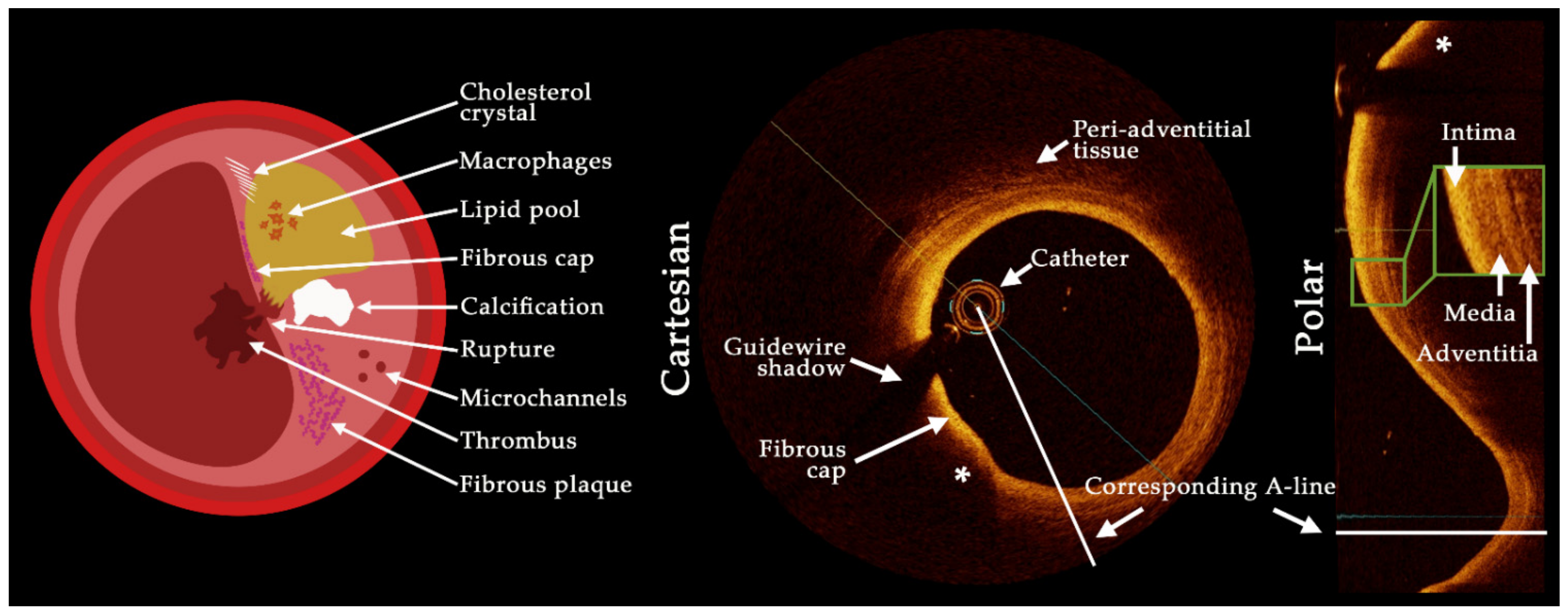 Tomography 08 00108 g001