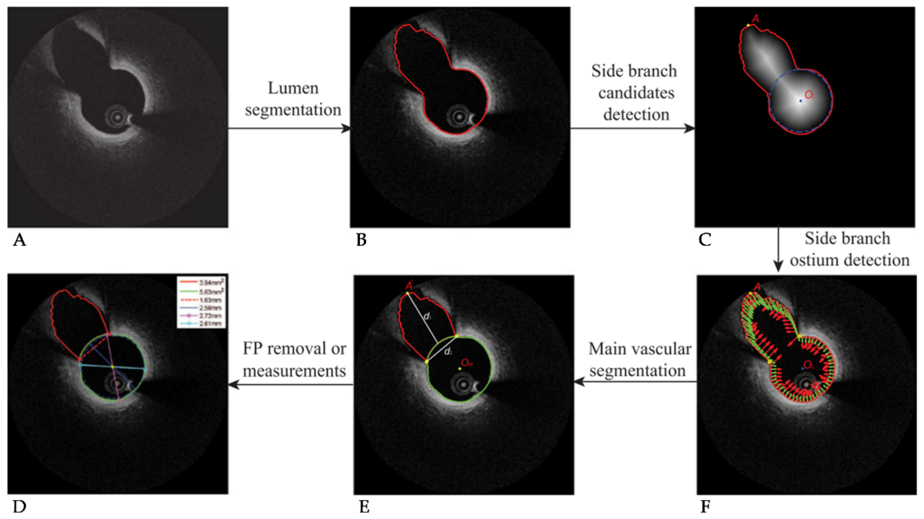 Tomography 08 00108 g004