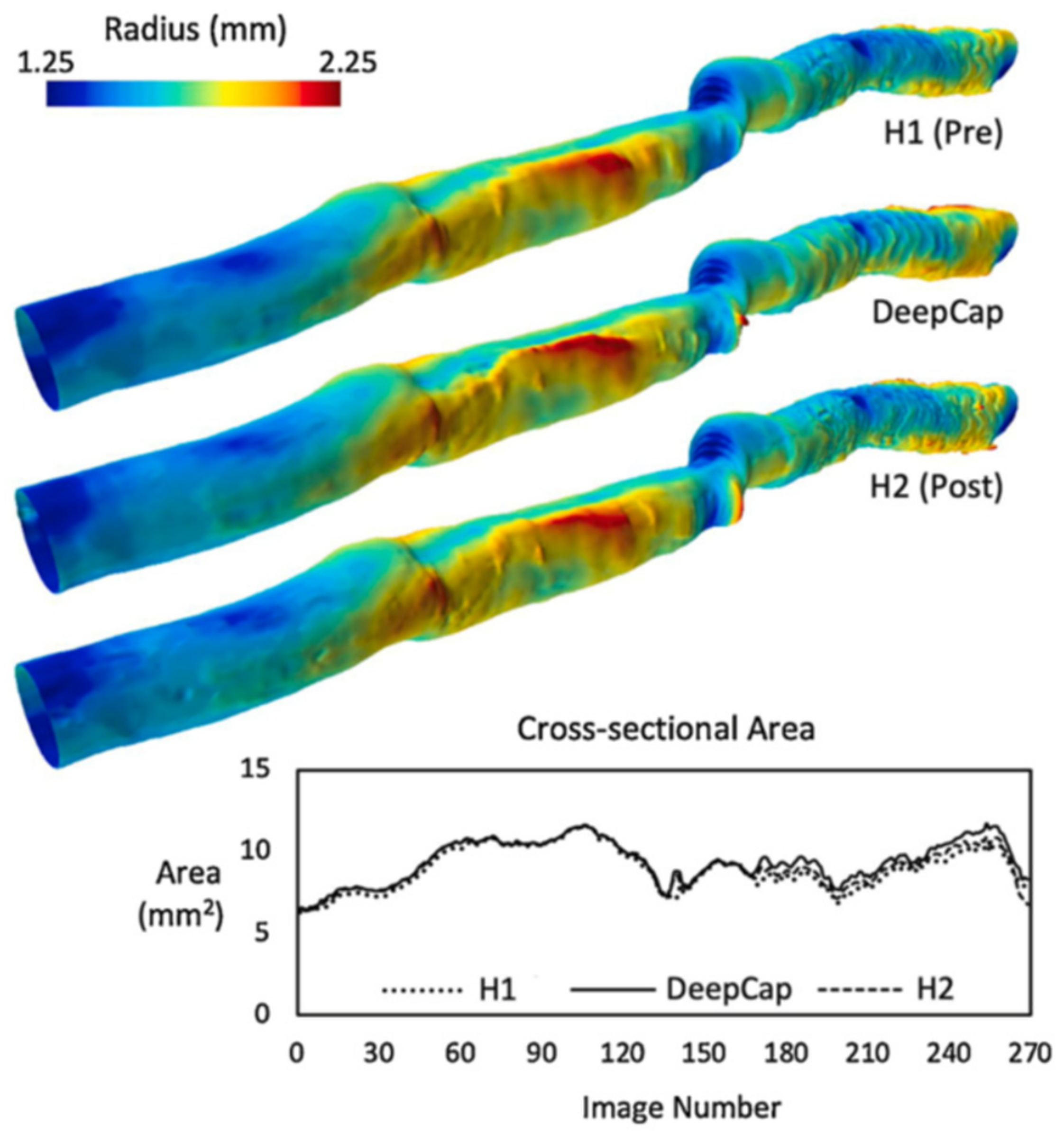 Tomography 08 00108 g005