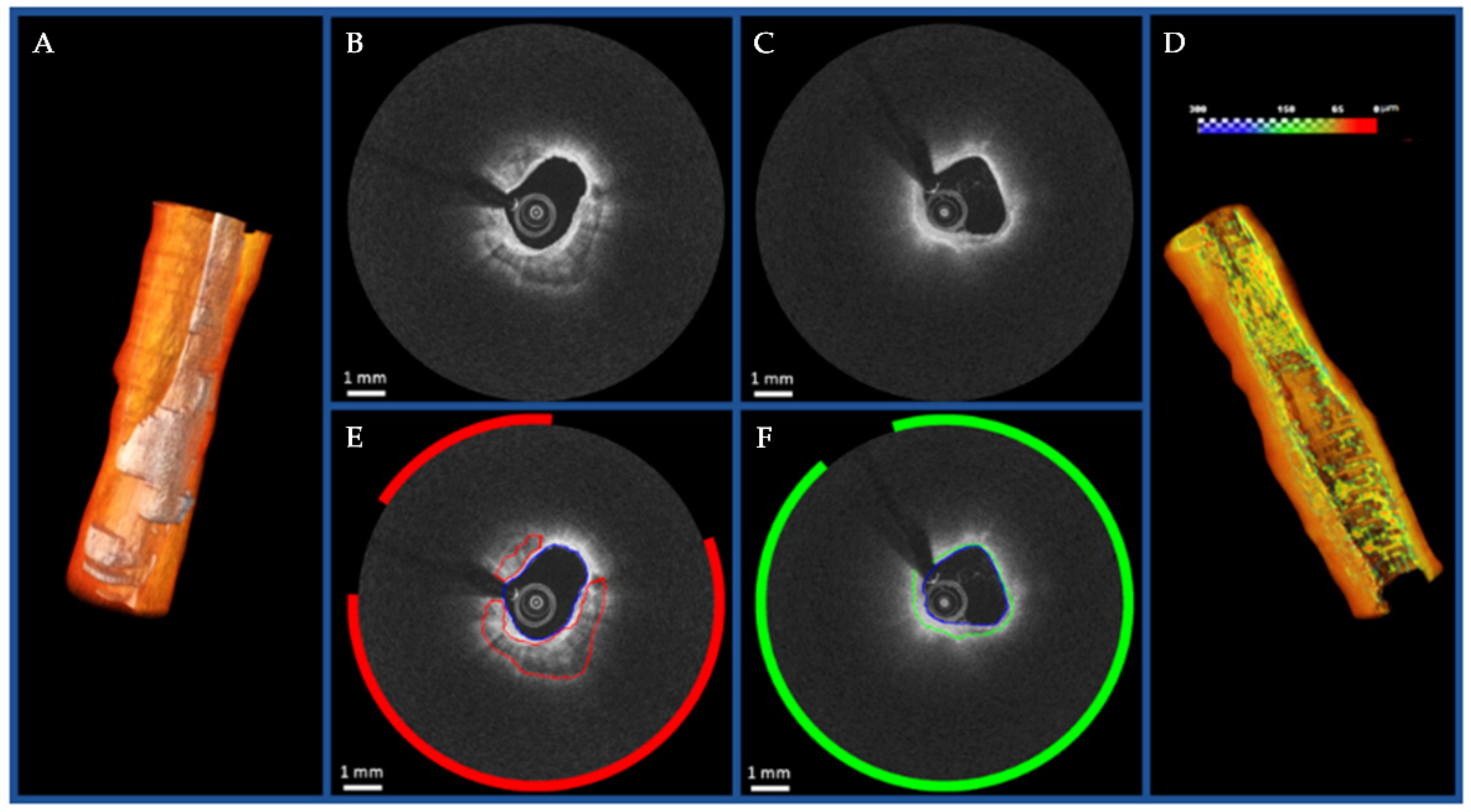 Tomography 08 00108 g008