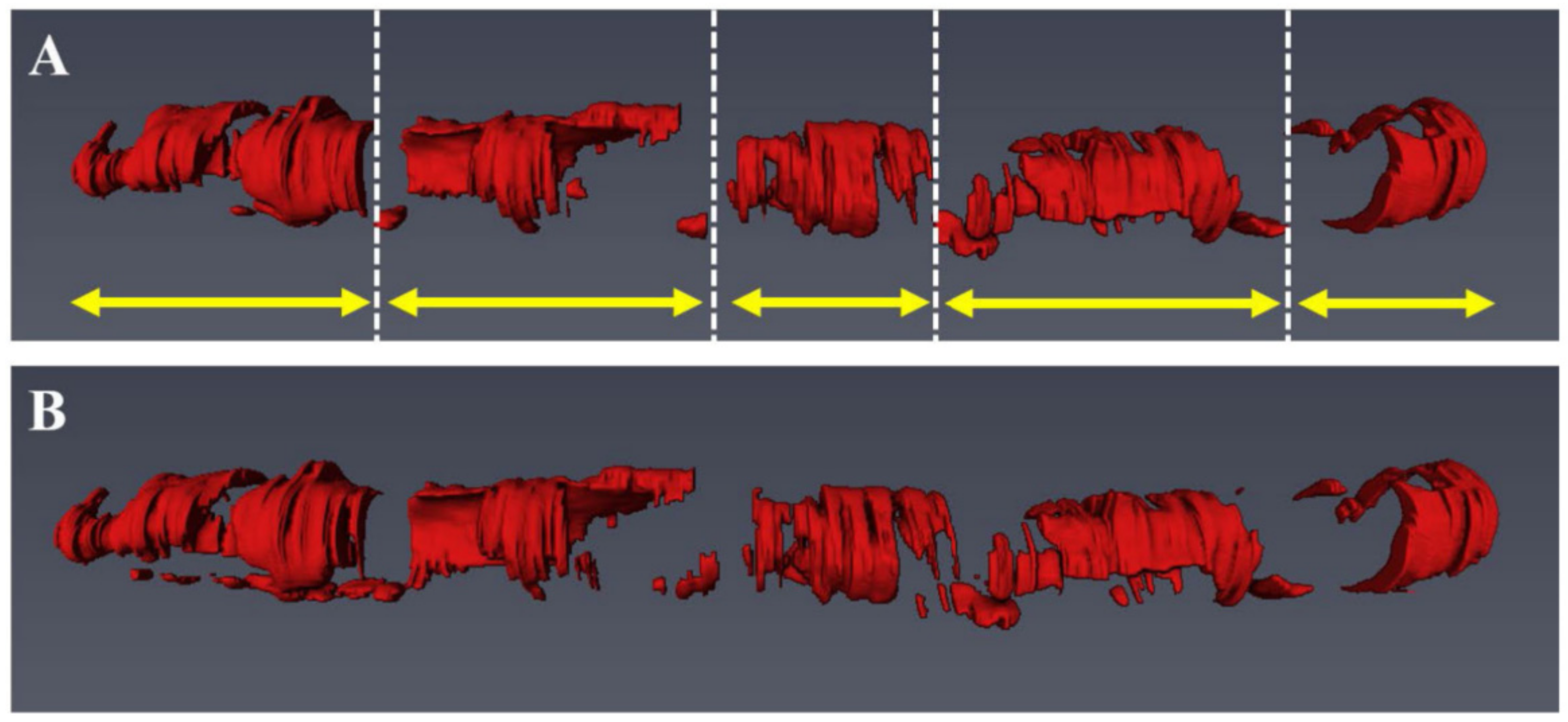 Tomography 08 00108 g010