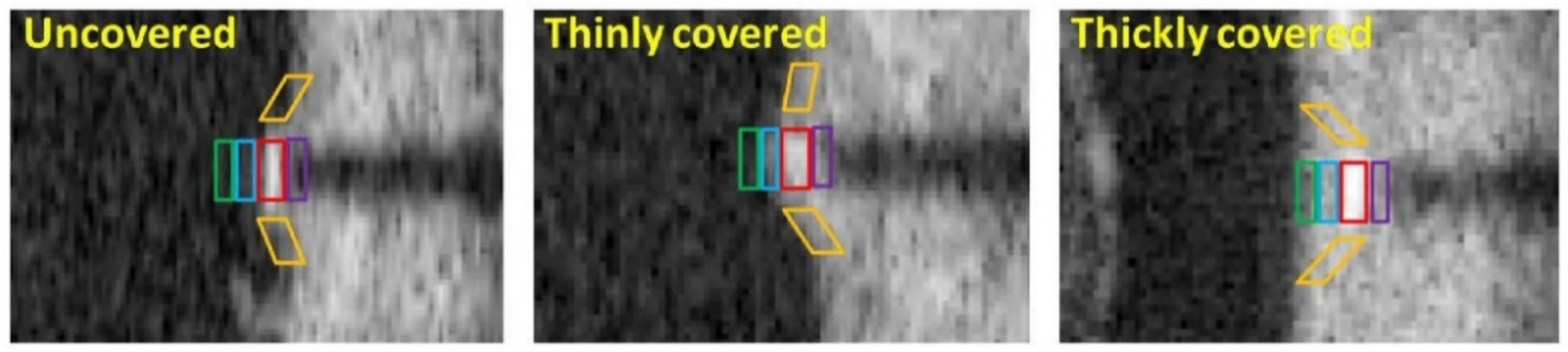 Tomography 08 00108 g011