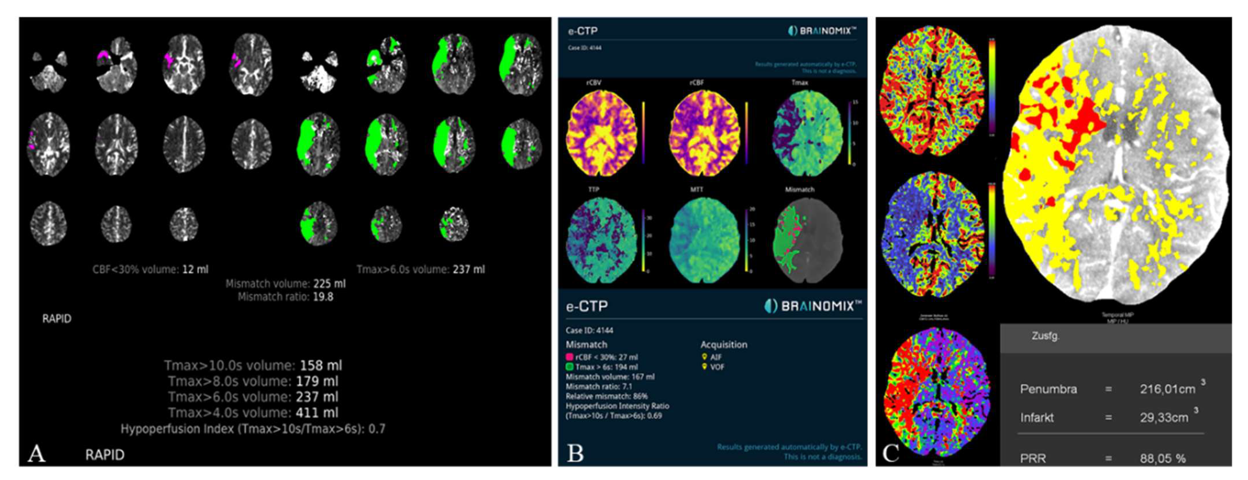 Tomography 08 00109 g003 Tomography 08 00109 g003