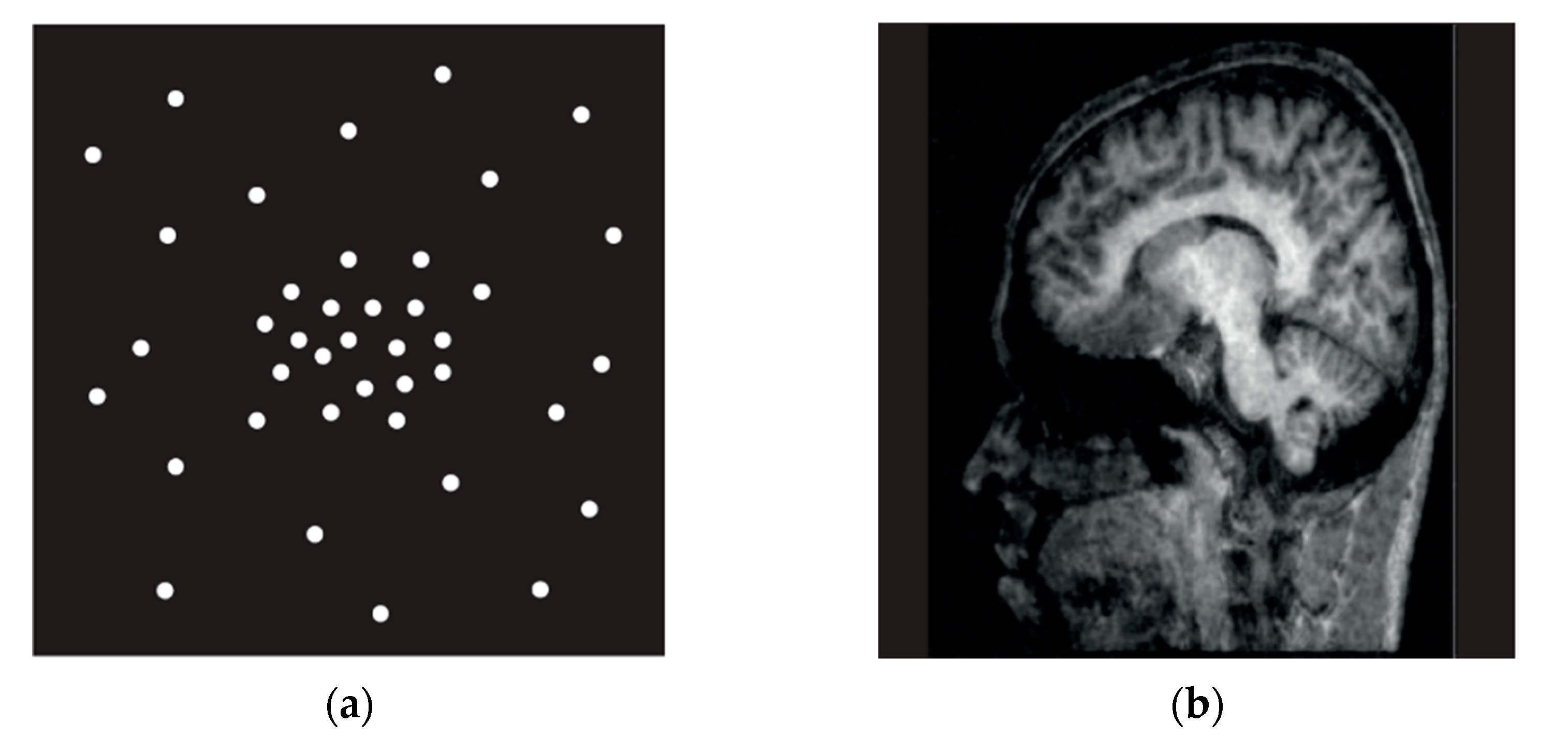 Tomography 08 00111 g002 Tomography 08 00111 g002