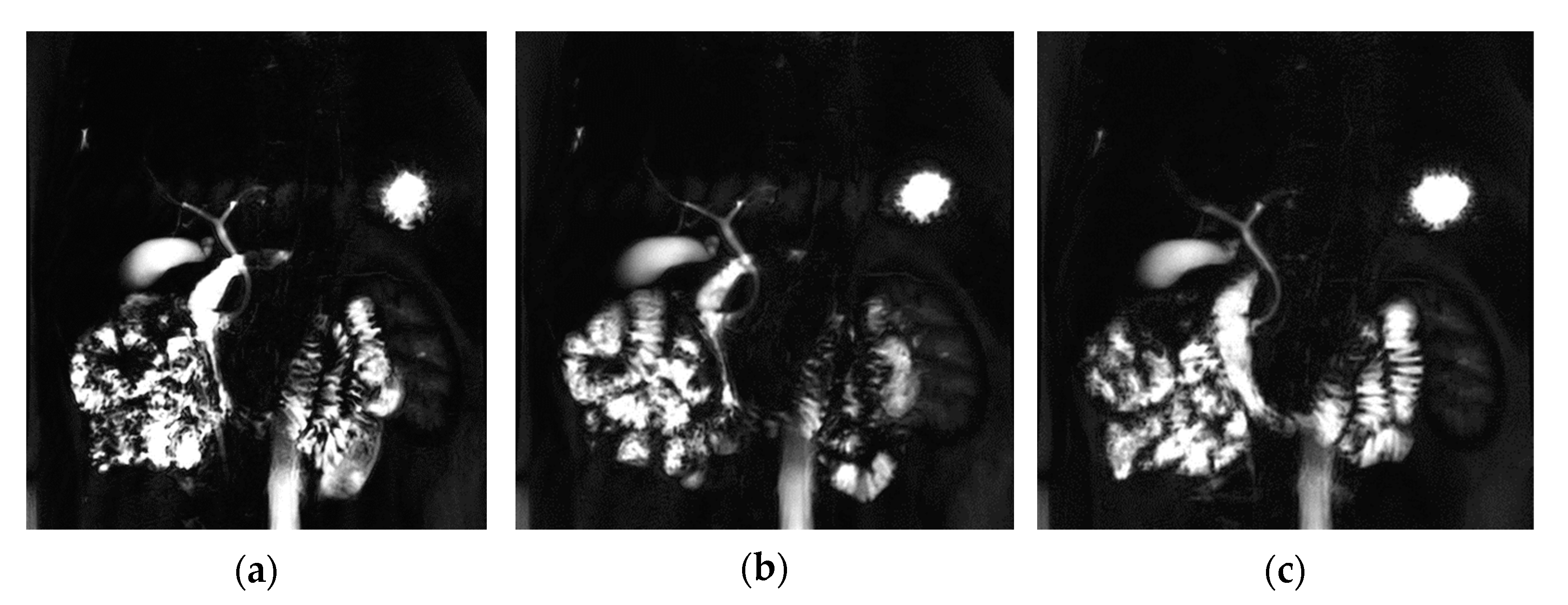 Tomography 08 00111 g005 Tomography 08 00111 g005