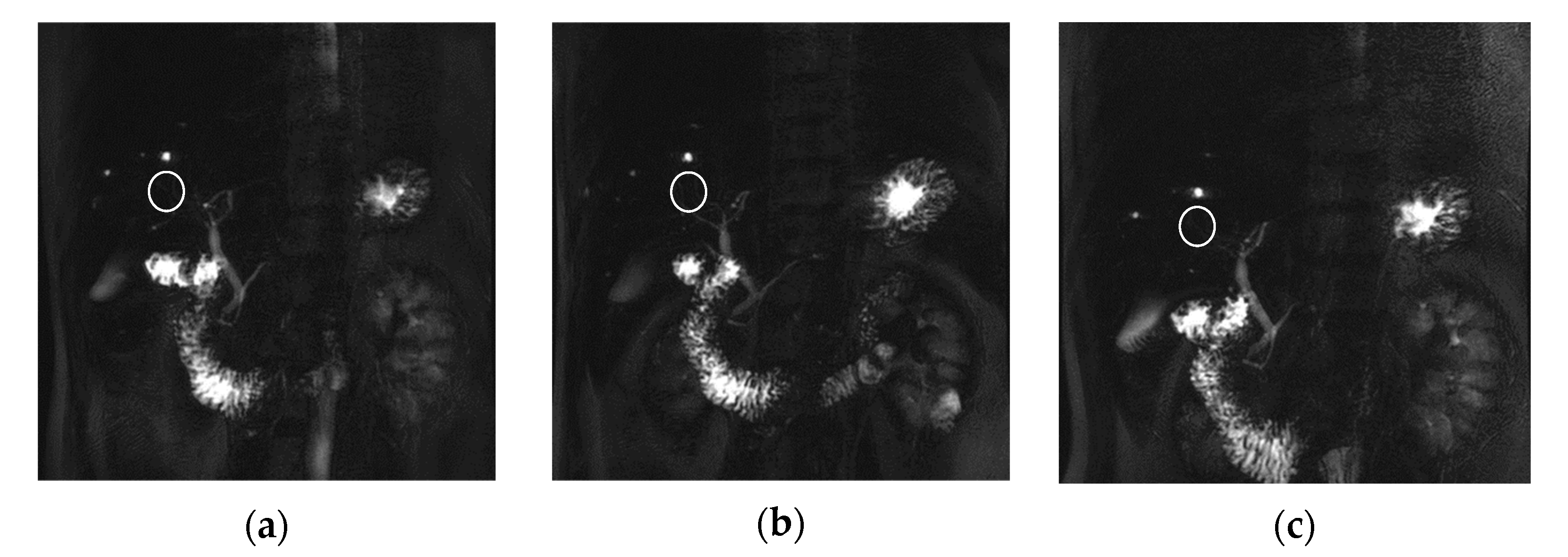 Tomography 08 00111 g006 Tomography 08 00111 g006