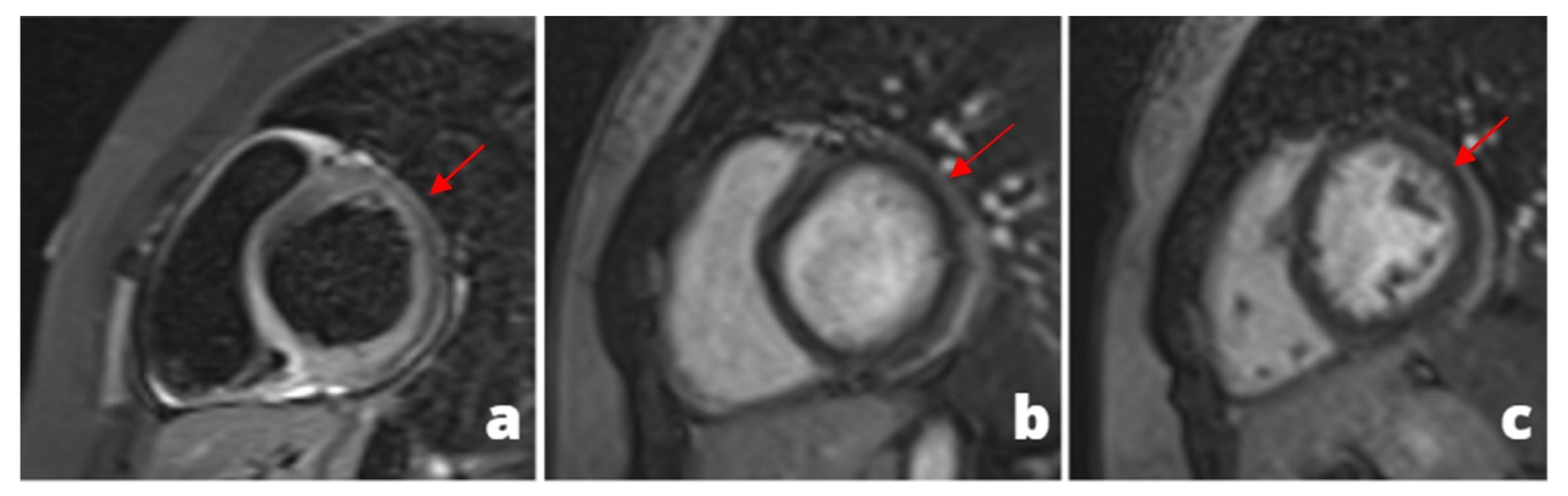 Tomography 08 00112 g002