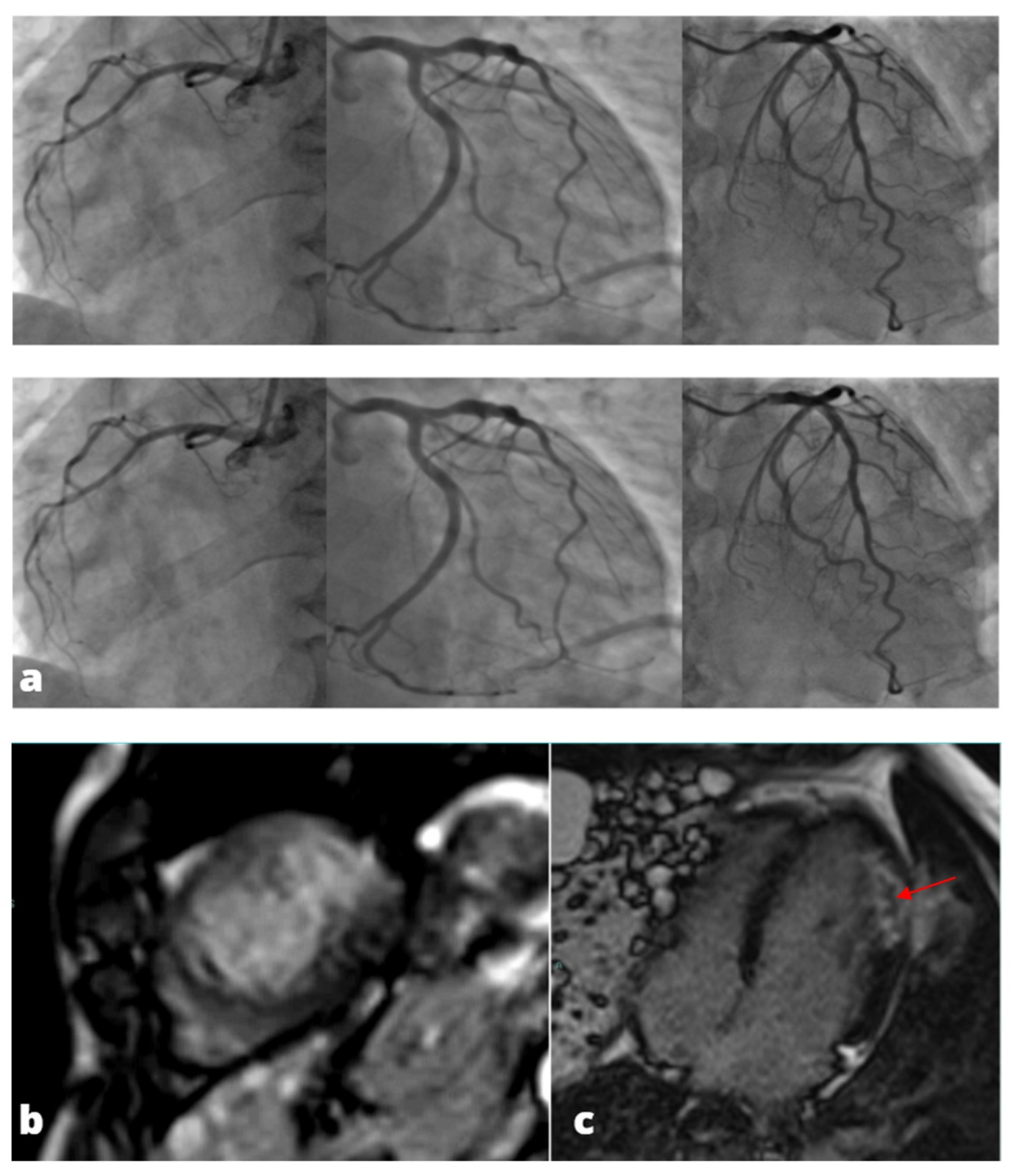 Tomography 08 00112 g003a