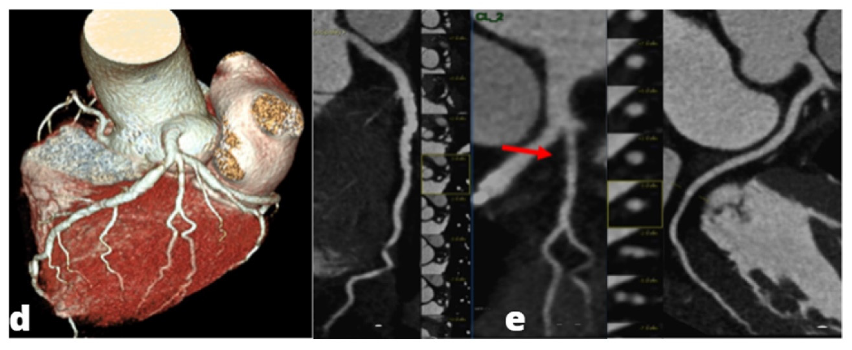 Tomography 08 00112 g003b