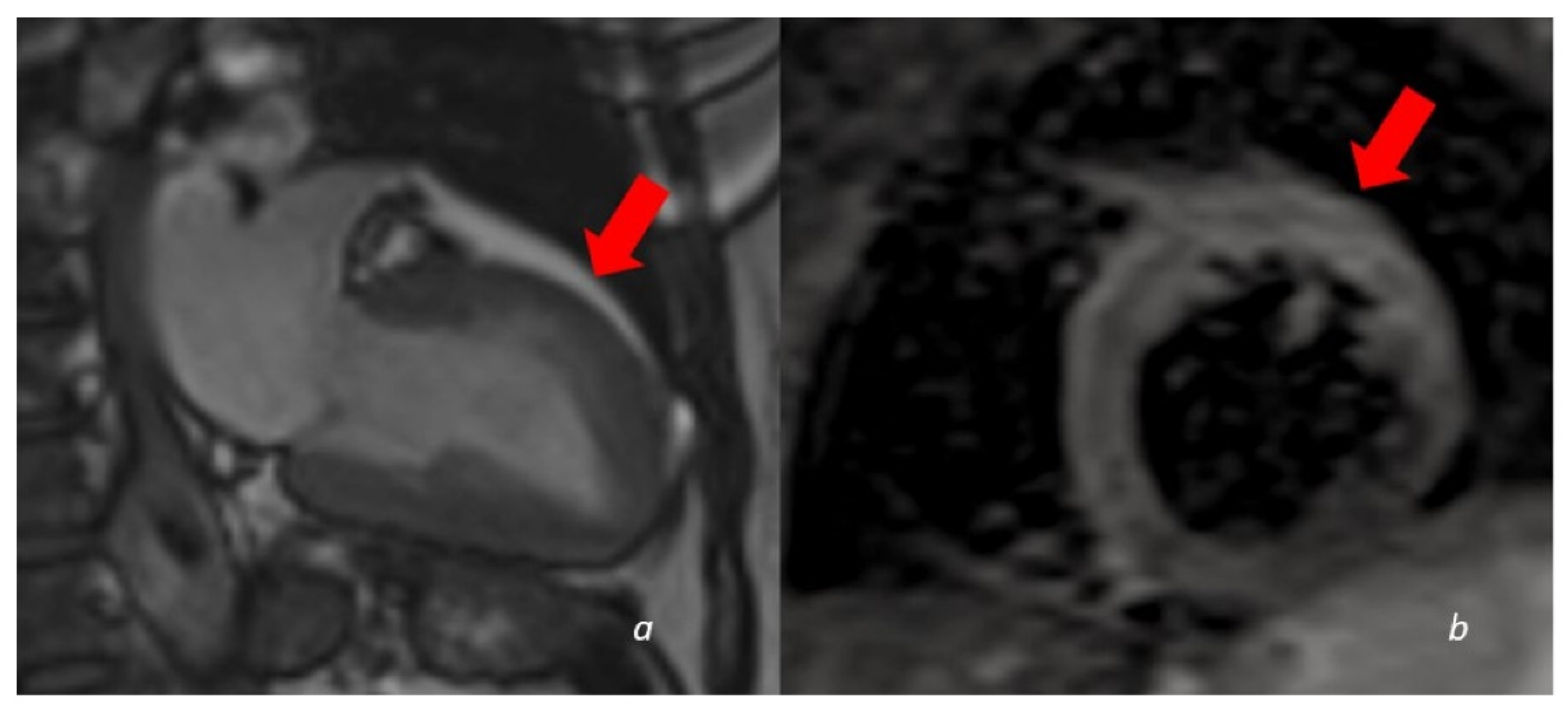 Tomography 08 00112 g004