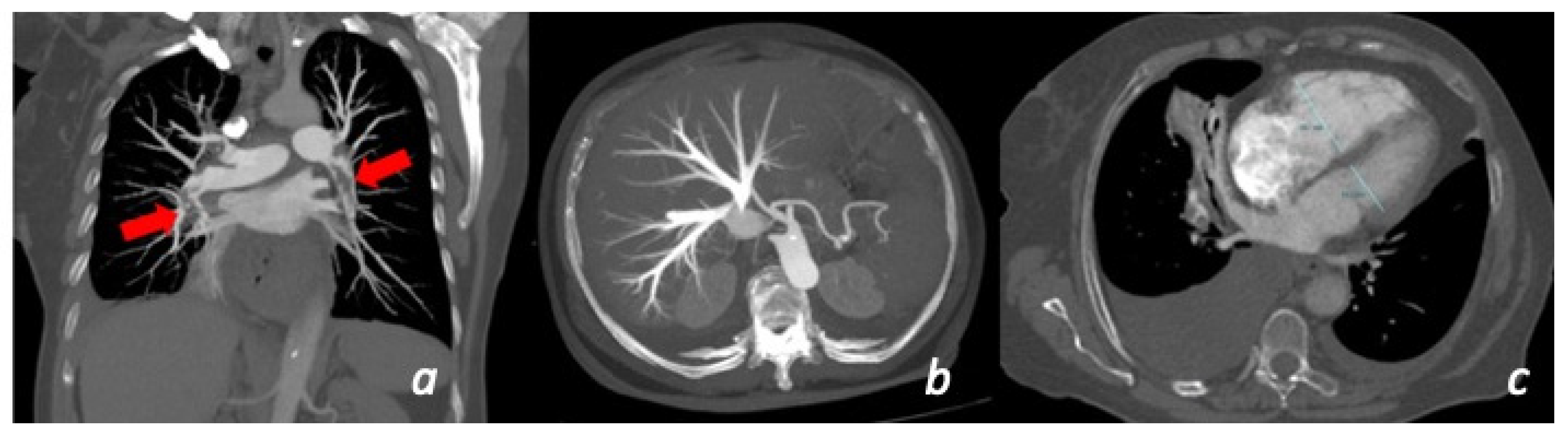 Tomography 08 00112 g006